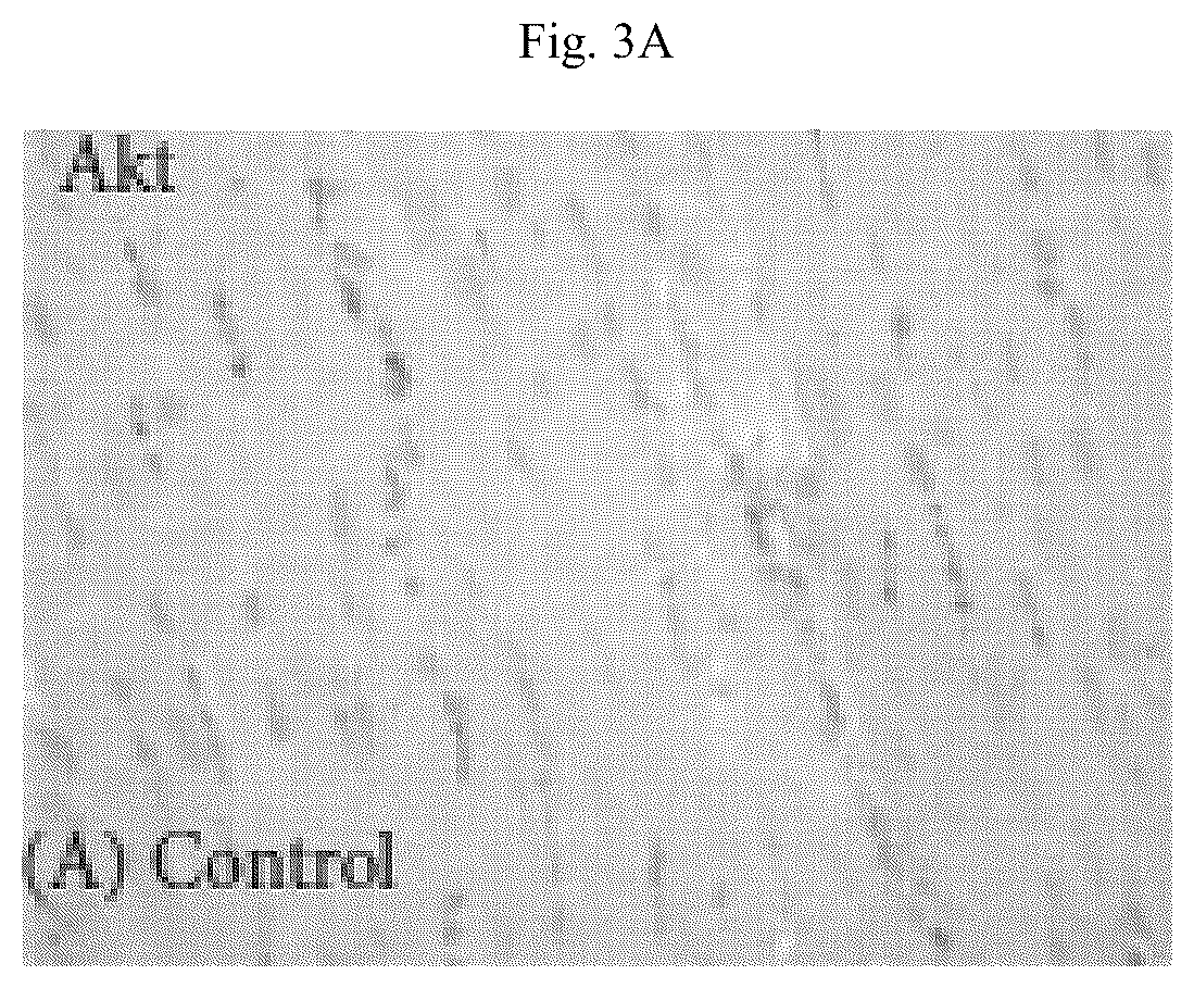 Patent US12564615 Figure 9 – Treatment method for cardiac hypertrophy