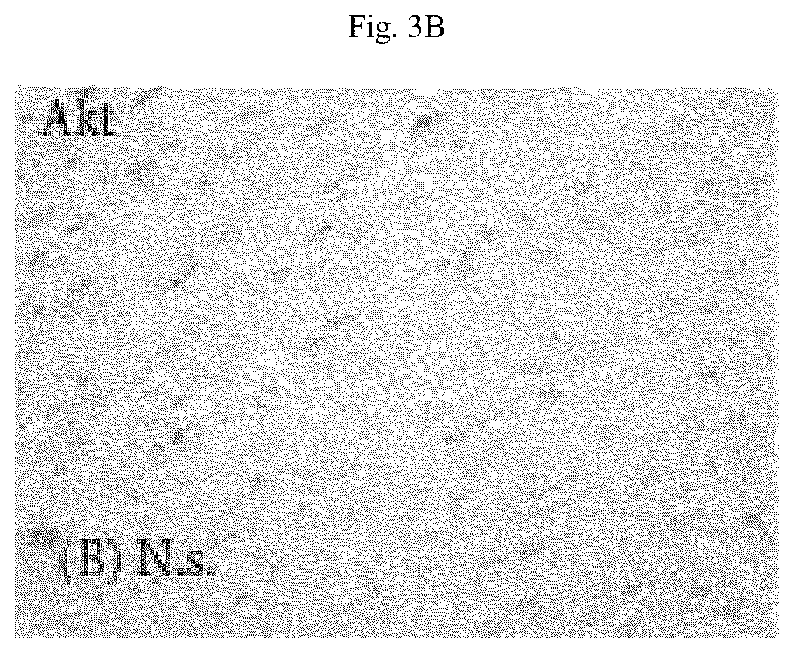 Patent US12564615 Figure 10 – Treatment method for cardiac hypertrophy