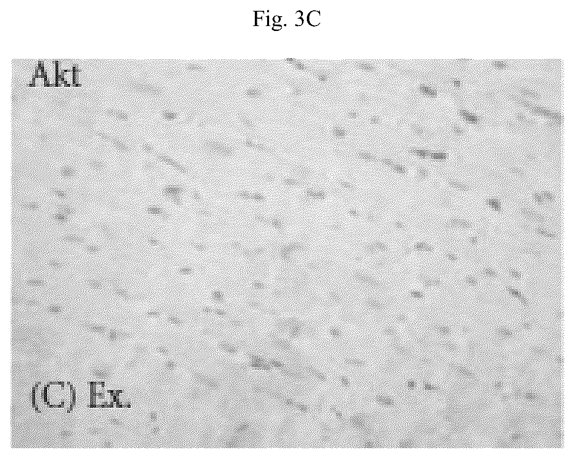 Patent US12564615 Figure 11 – Treatment method for cardiac hypertrophy