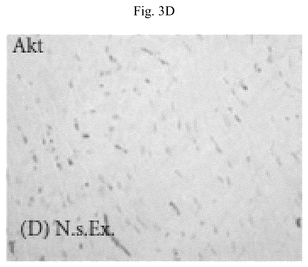 Patent US12564615 Figure 12 – Treatment method for cardiac hypertrophy