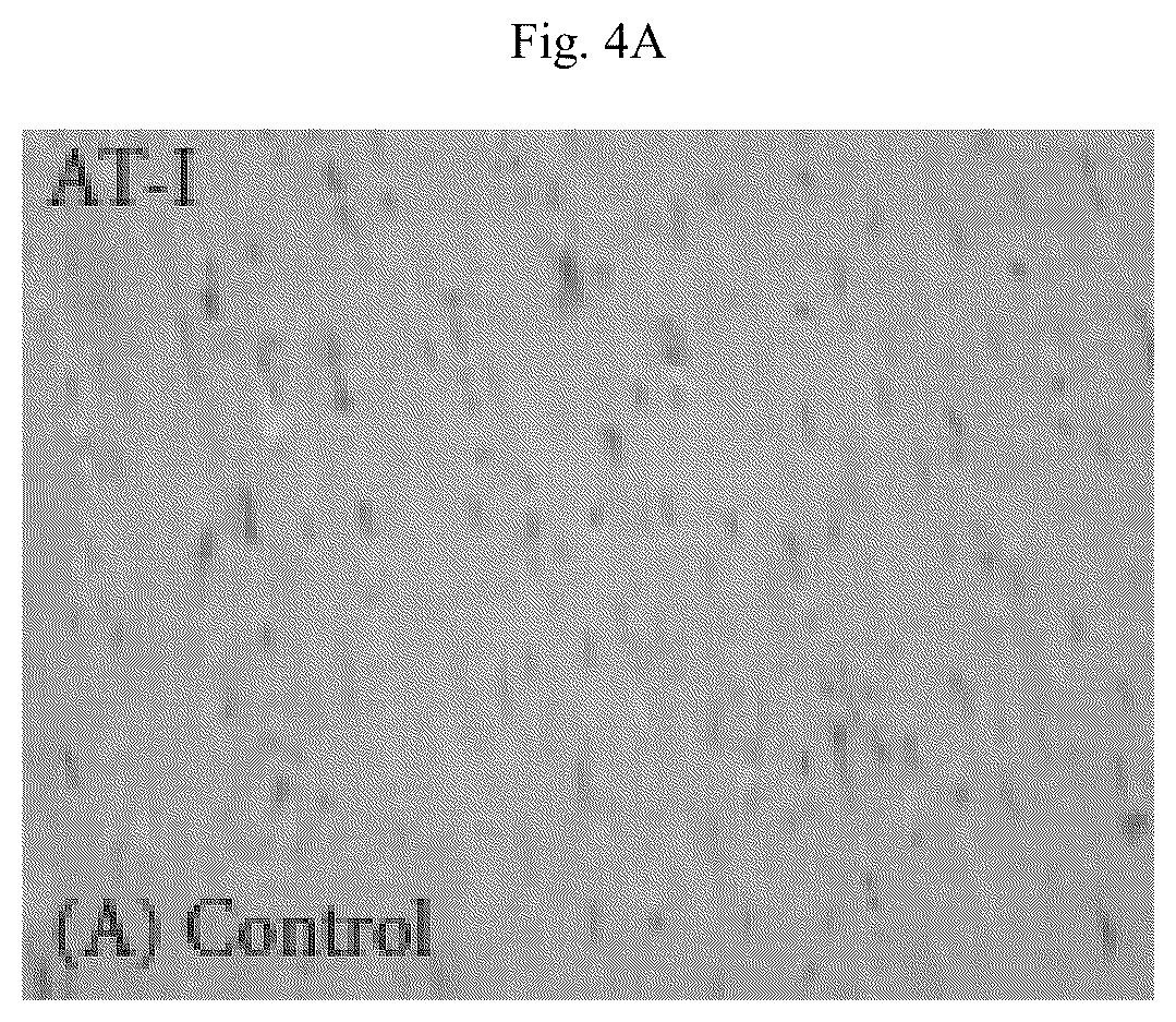 Patent US12564615 Figure 13 – Treatment method for cardiac hypertrophy