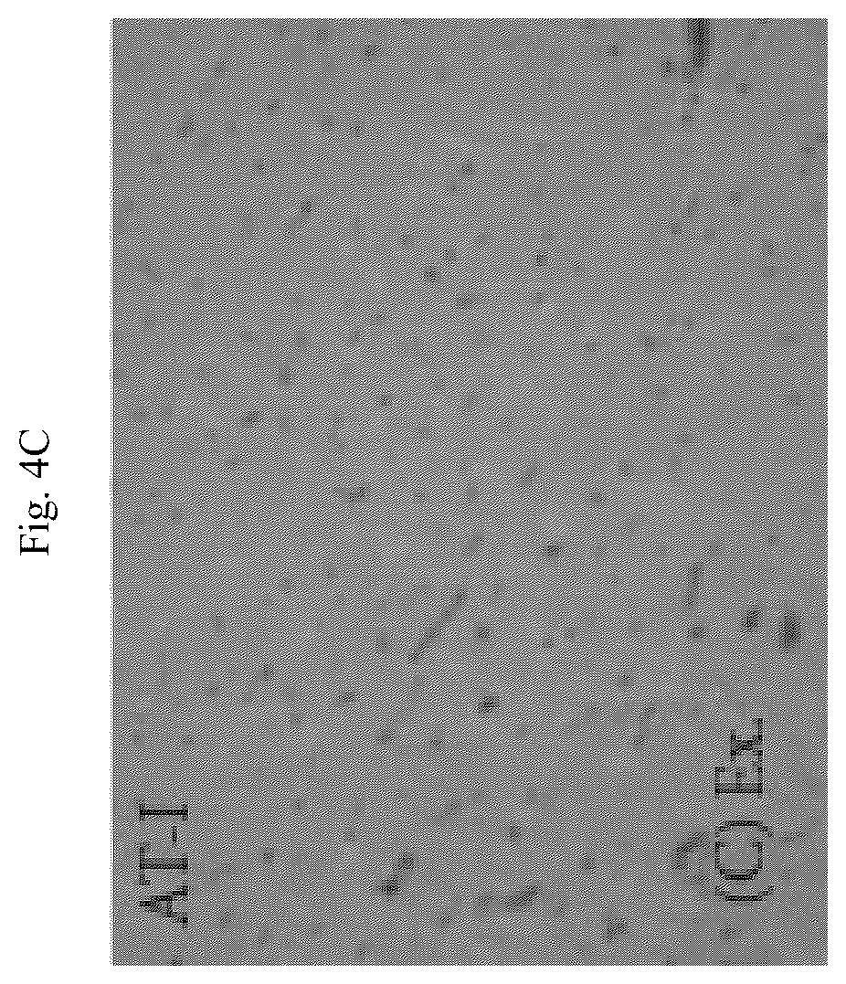 Patent US12564615 Figure 15 – Treatment method for cardiac hypertrophy