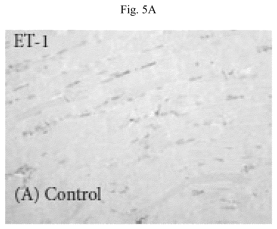 Patent US12564615 Figure 17 – Treatment method for cardiac hypertrophy