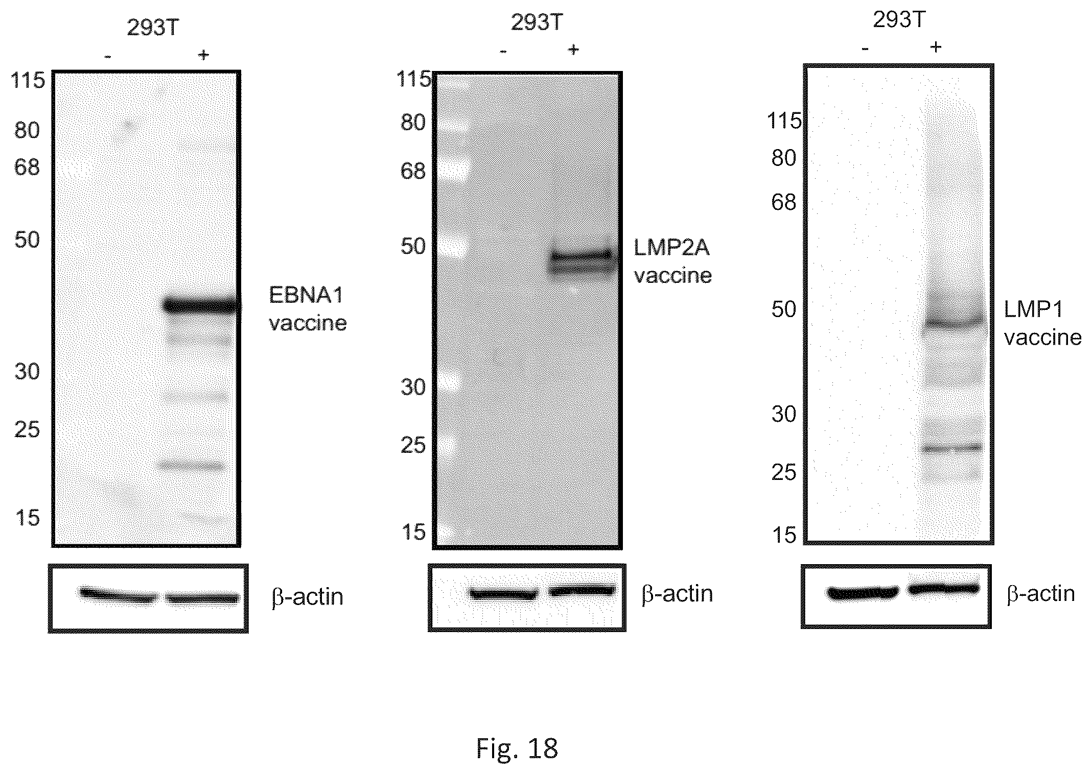 Patent US12564628 Figure 15 – Epstein-BARR virus nucleic acid constructs and vaccines made therefrom, and methods of using same