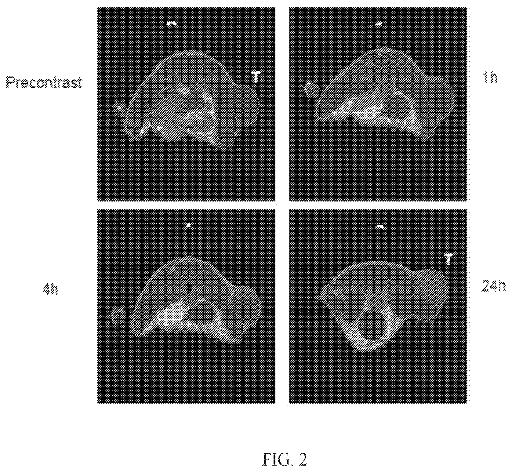 Patent US12564635 Figure 2 – Long-lived gadolinium based tumor targeted imaging and therapy agents