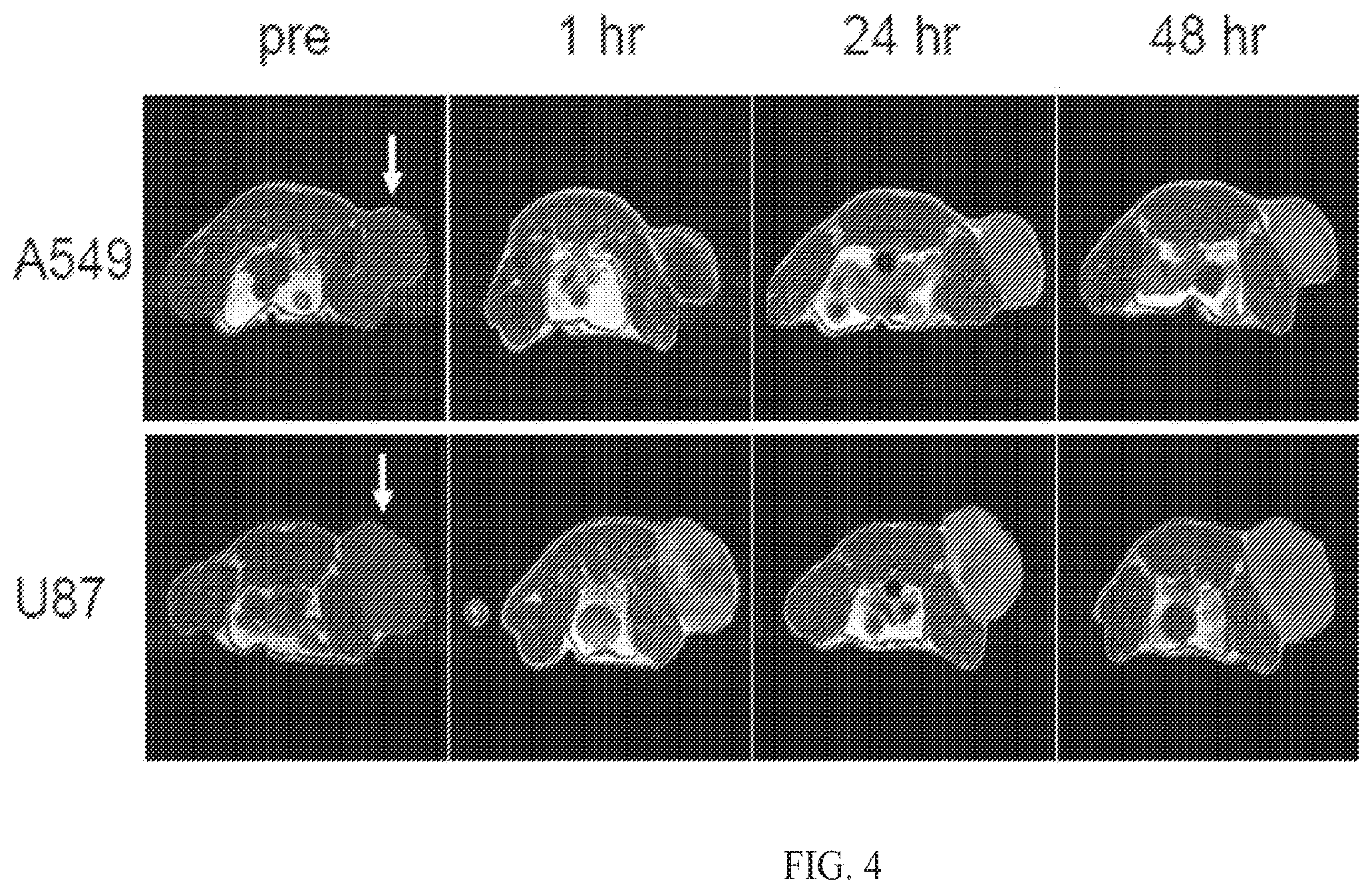 Patent US12564635 Figure 4 – Long-lived gadolinium based tumor targeted imaging and therapy agents