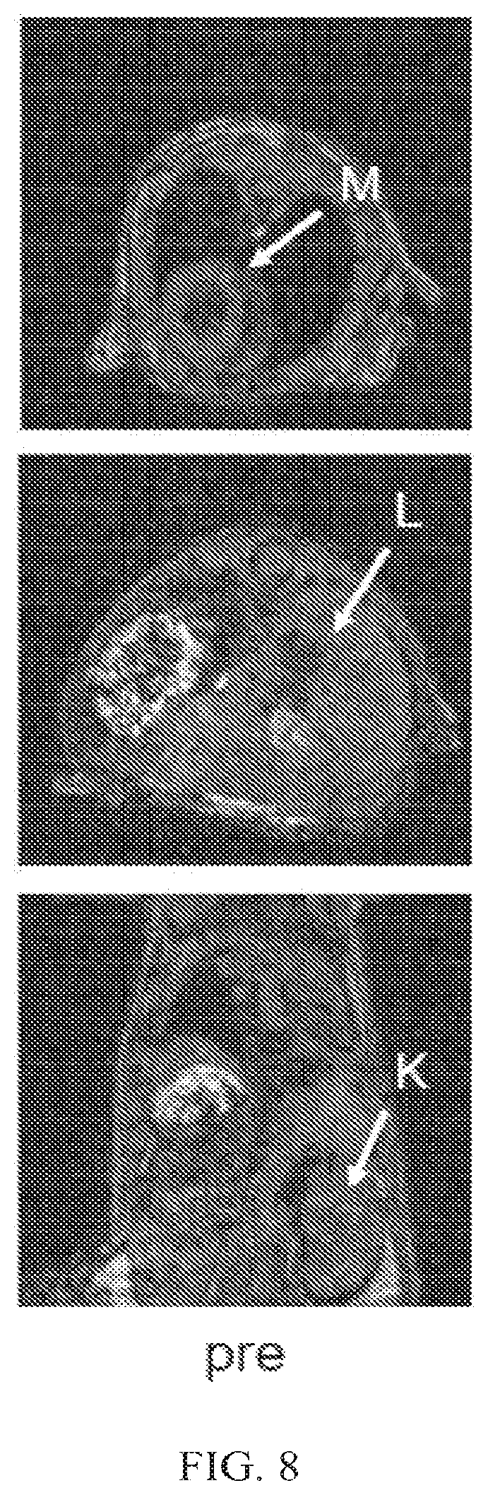 Patent US12564635 Figure 8 – Long-lived gadolinium based tumor targeted imaging and therapy agents