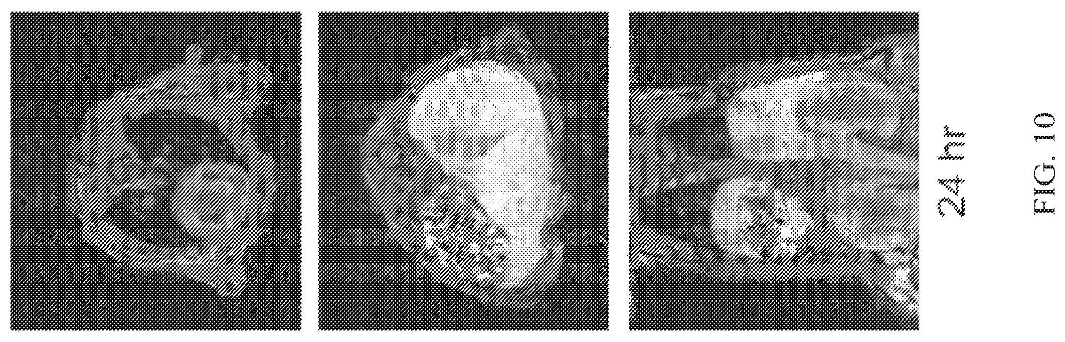 Patent US12564635 Figure 10 – Long-lived gadolinium based tumor targeted imaging and therapy agents