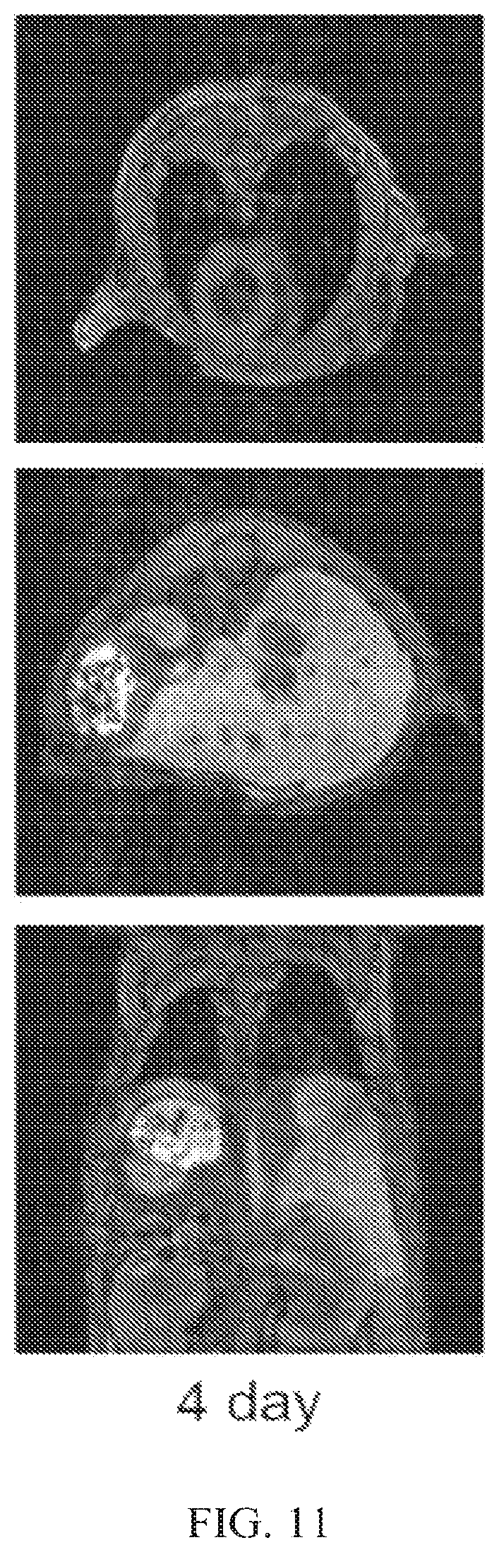 Patent US12564635 Figure 11 – Long-lived gadolinium based tumor targeted imaging and therapy agents