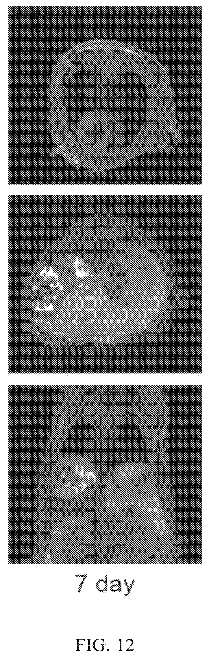 Patent US12564635 Figure 12 – Long-lived gadolinium based tumor targeted imaging and therapy agents