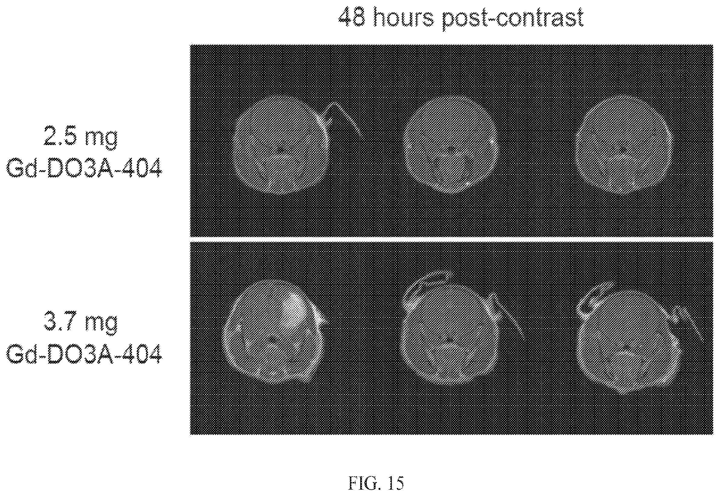 Patent US12564635 Figure 15 – Long-lived gadolinium based tumor targeted imaging and therapy agents