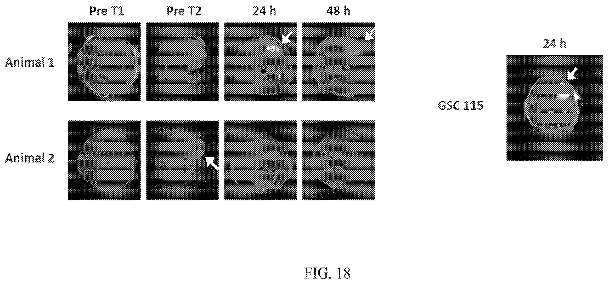 Patent US12564635 Figure 18 – Long-lived gadolinium based tumor targeted imaging and therapy agents