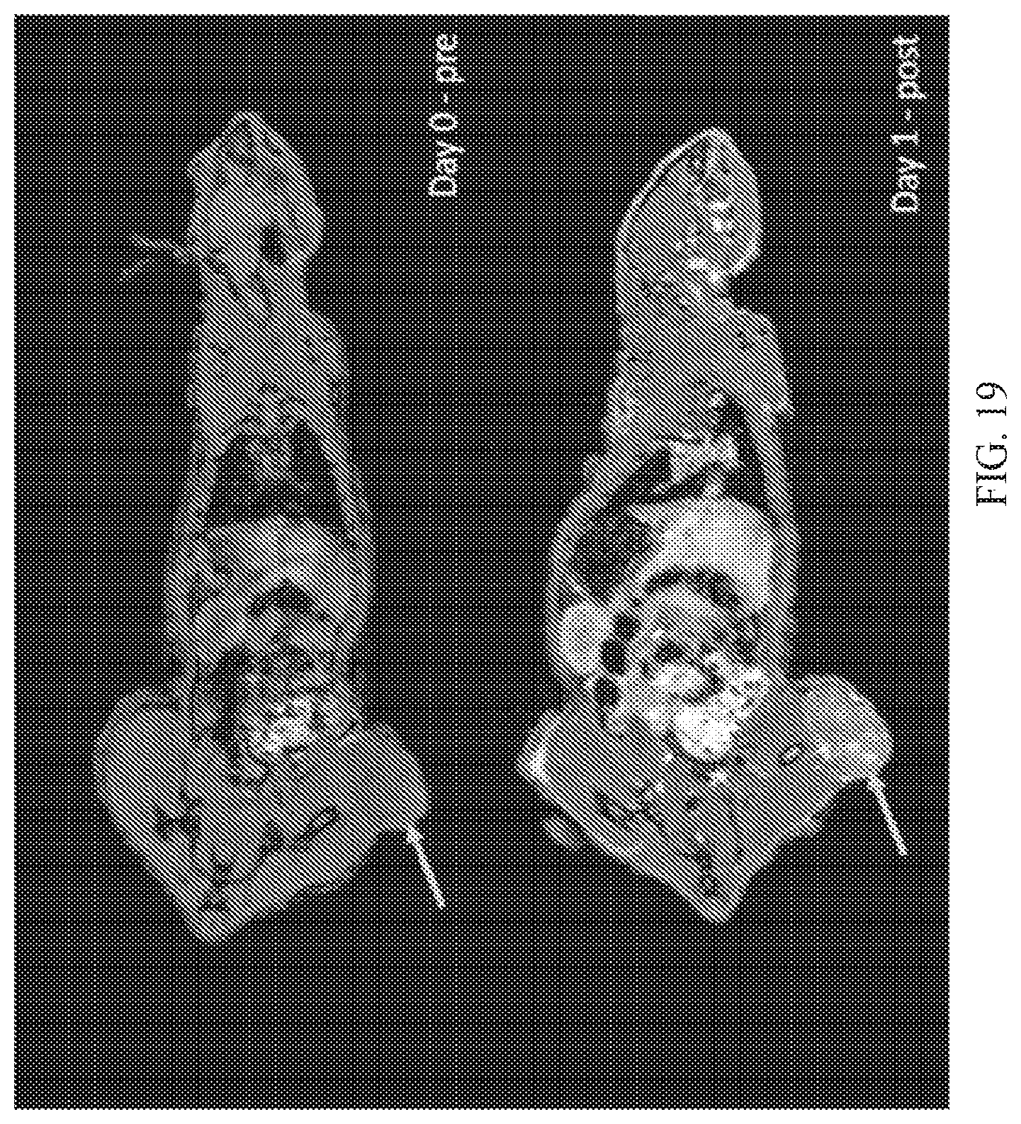 Patent US12564635 Figure 19 – Long-lived gadolinium based tumor targeted imaging and therapy agents
