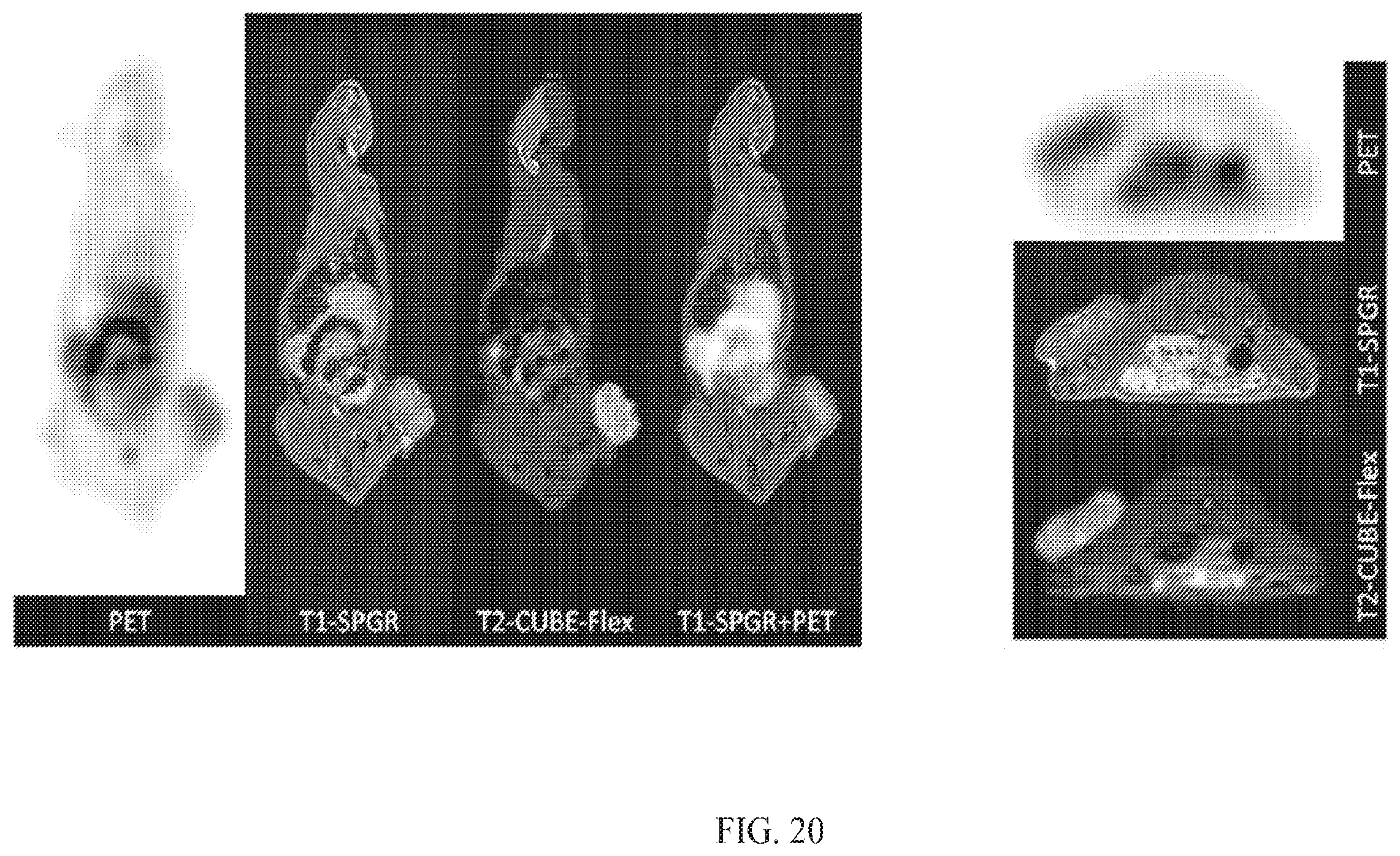 Patent US12564635 Figure 20 – Long-lived gadolinium based tumor targeted imaging and therapy agents