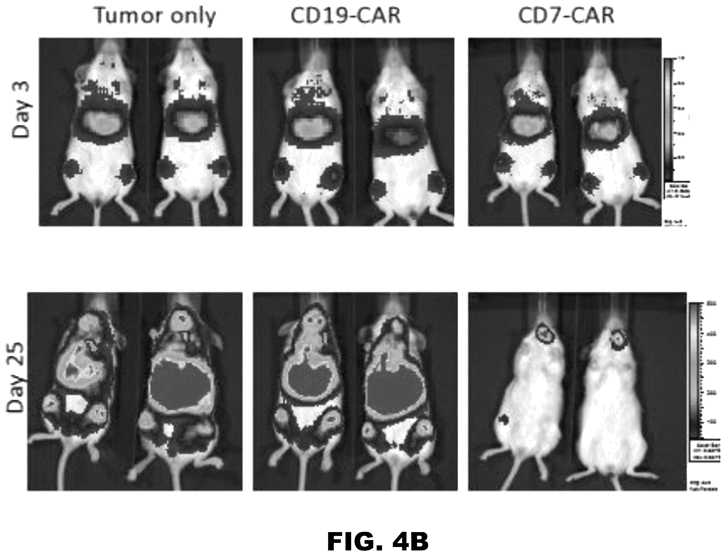 Patent US12564648 Figure 5 – Gene editing of CAR-T cells for the treatment of T cell malignancies with chimeric antigen receptors