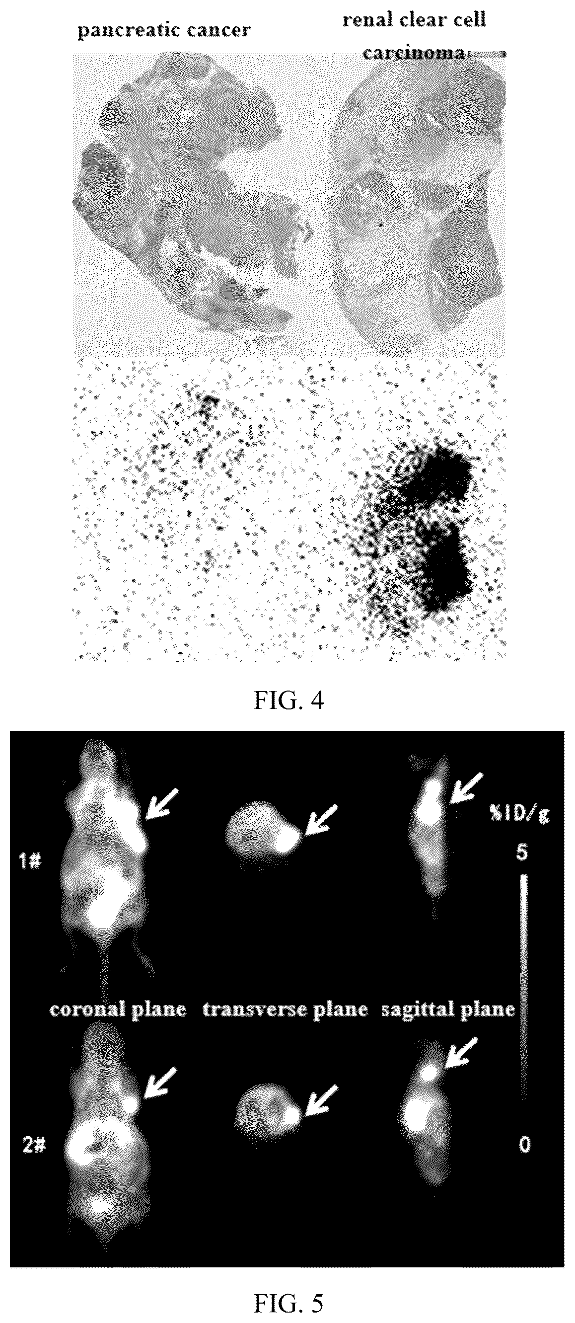 Patent US12564650 Figure 4 – Carbonic anhydrase IX-targeting radioactive diagnostic and therapeutic medicament and method for preparing same
