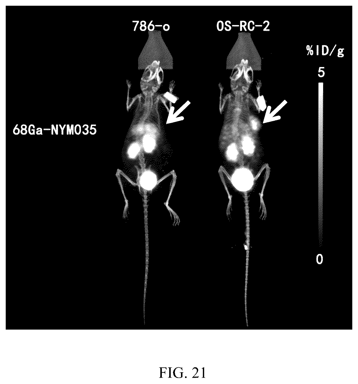 Patent US12564650 Figure 15 – Carbonic anhydrase IX-targeting radioactive diagnostic and therapeutic medicament and method for preparing same