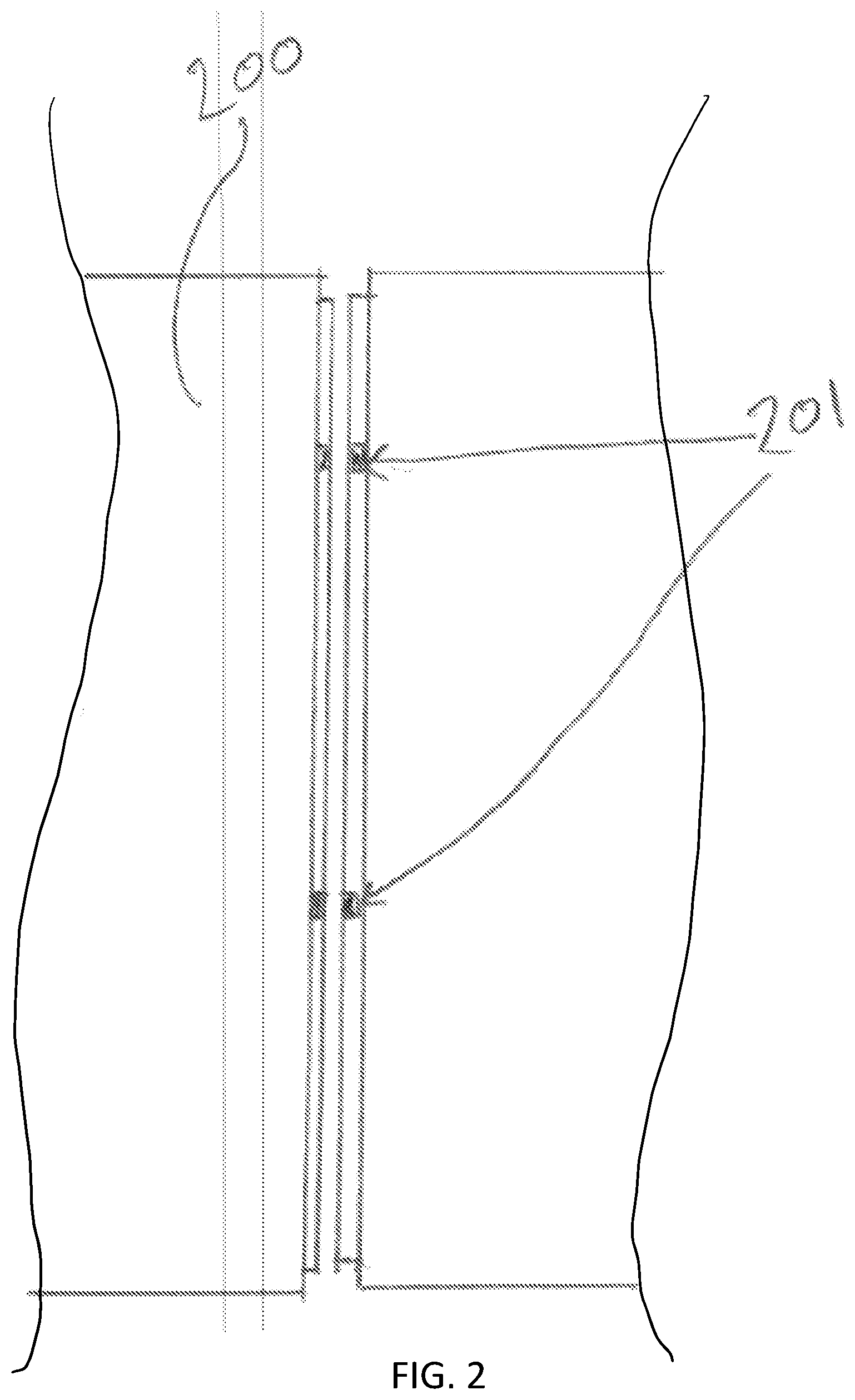 Patent US12564652 Figure 3 – Elevator sterilization system and method of using same