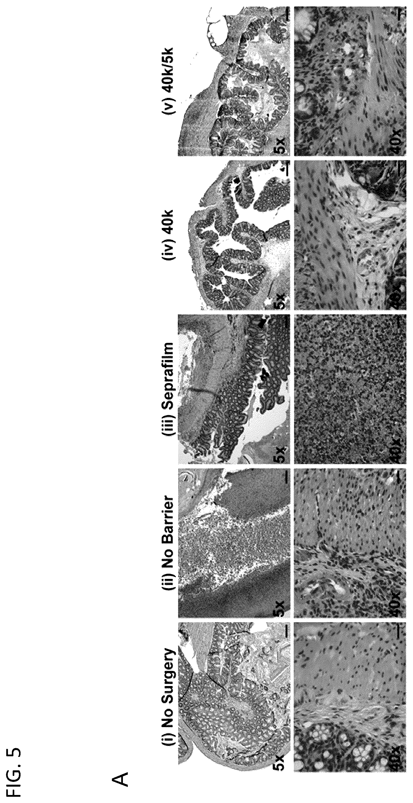 Patent US12564656 Figure 9 – Sprayable tissue adhesive with biodegradation for wound treatment