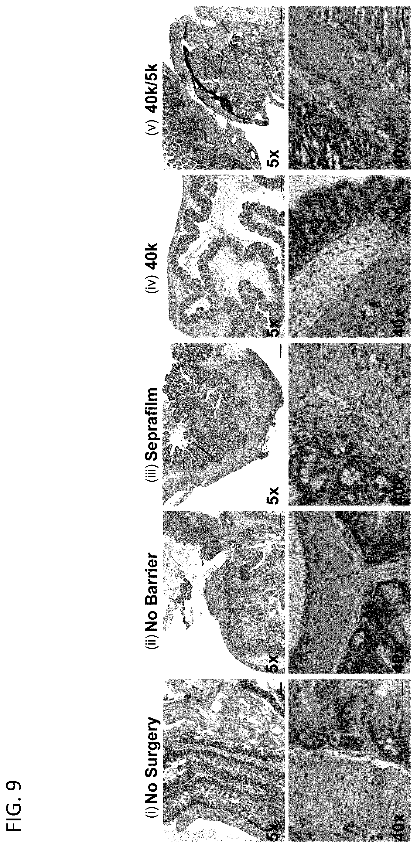 Patent US12564656 Figure 16 – Sprayable tissue adhesive with biodegradation for wound treatment