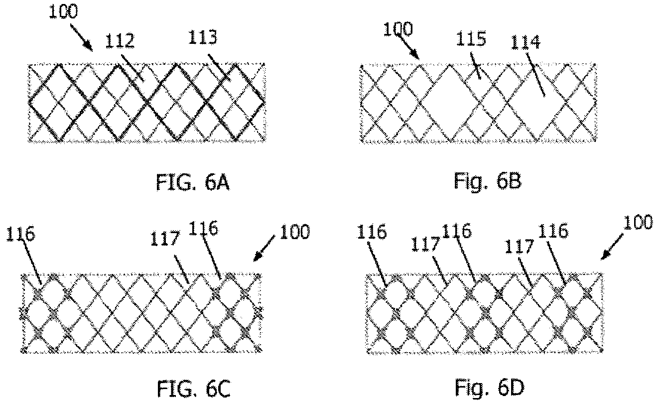 Patent US12564659 Figure 6 – Implantable scaffolds for treatment of sinusitis