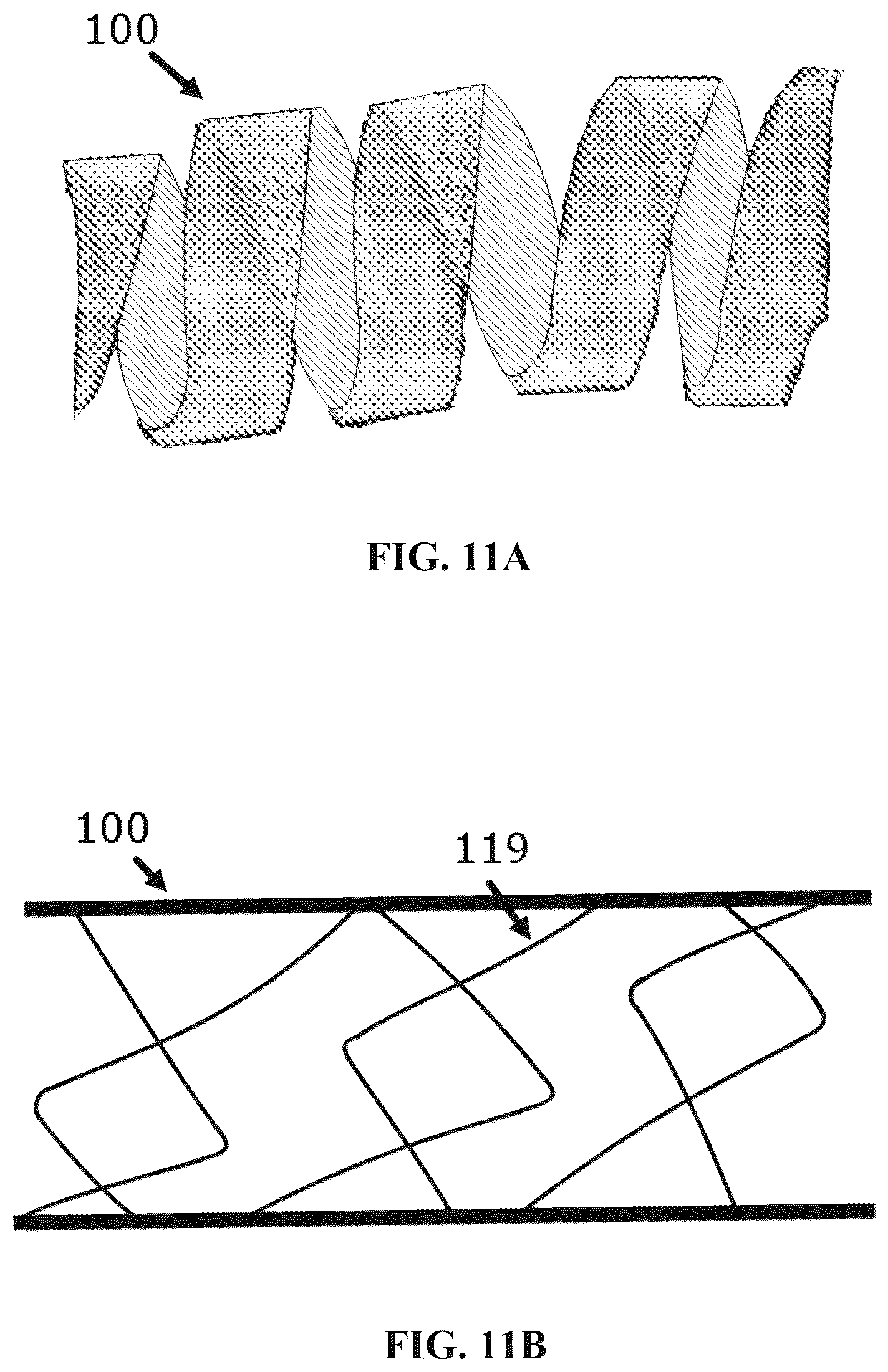 Patent US12564659 Figure 11 – Implantable scaffolds for treatment of sinusitis