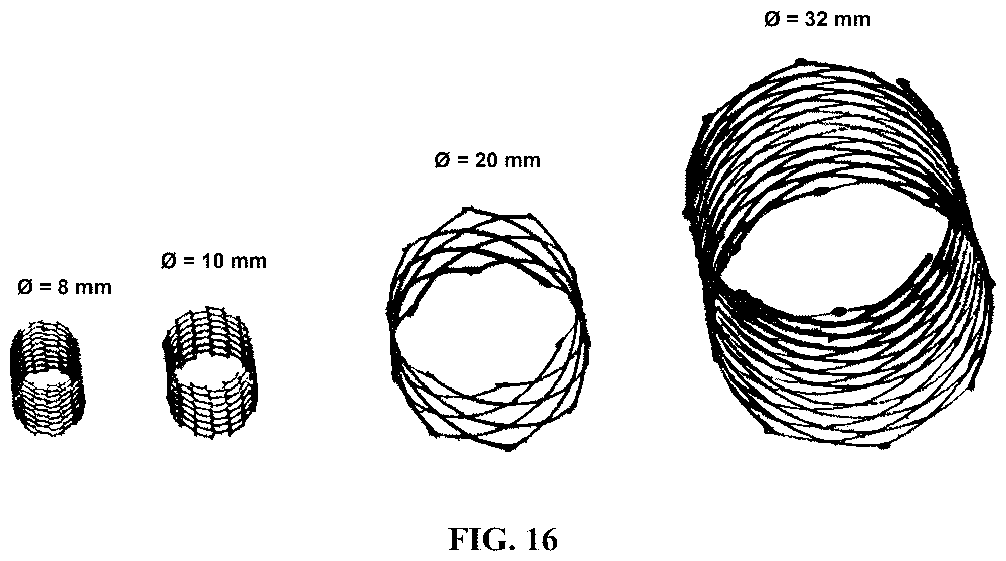 Patent US12564659 Figure 16 – Implantable scaffolds for treatment of sinusitis