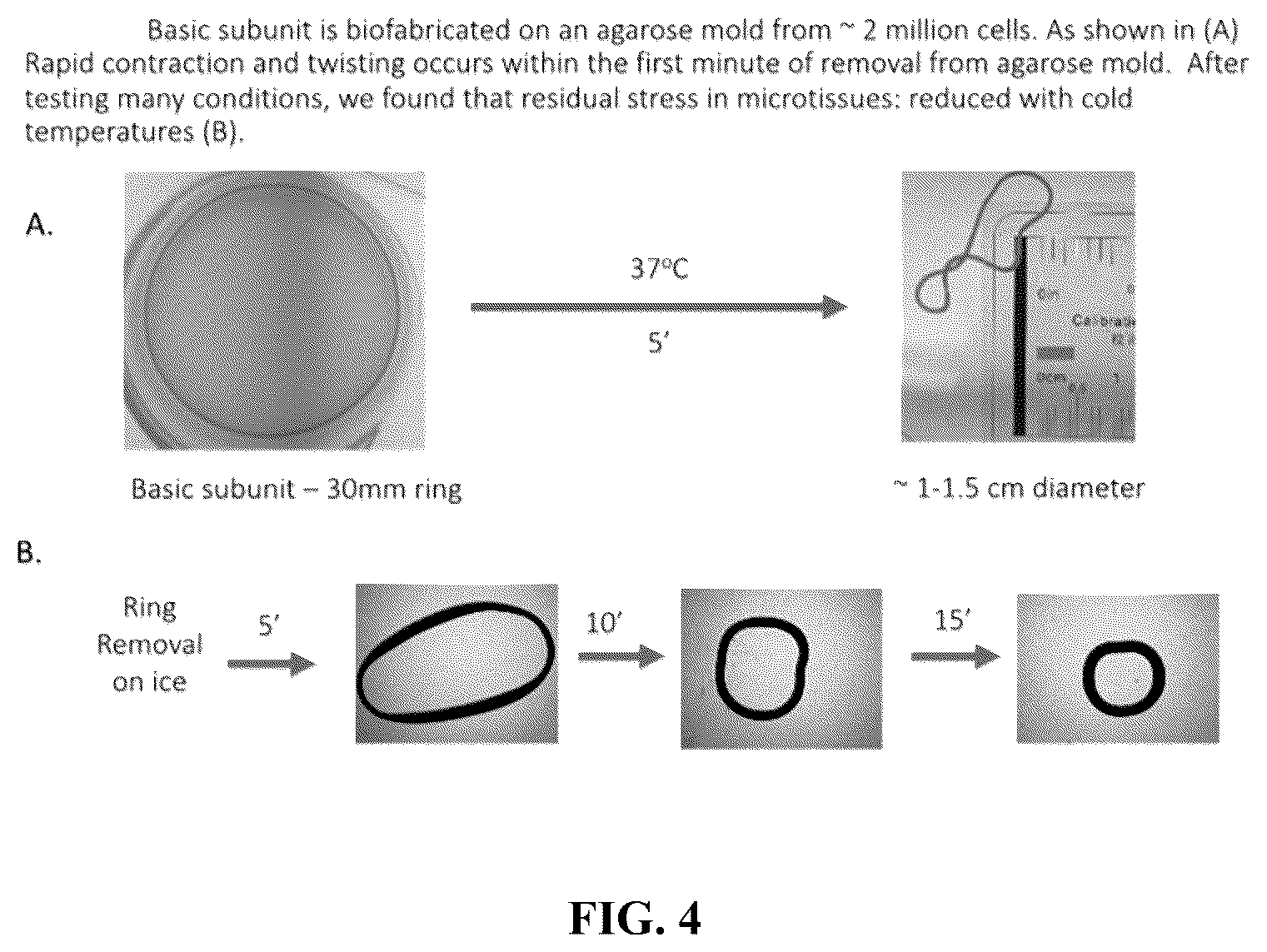 Patent US12564660 Figure 4 – Biofabrication of vaginal support using vaginally derived cells