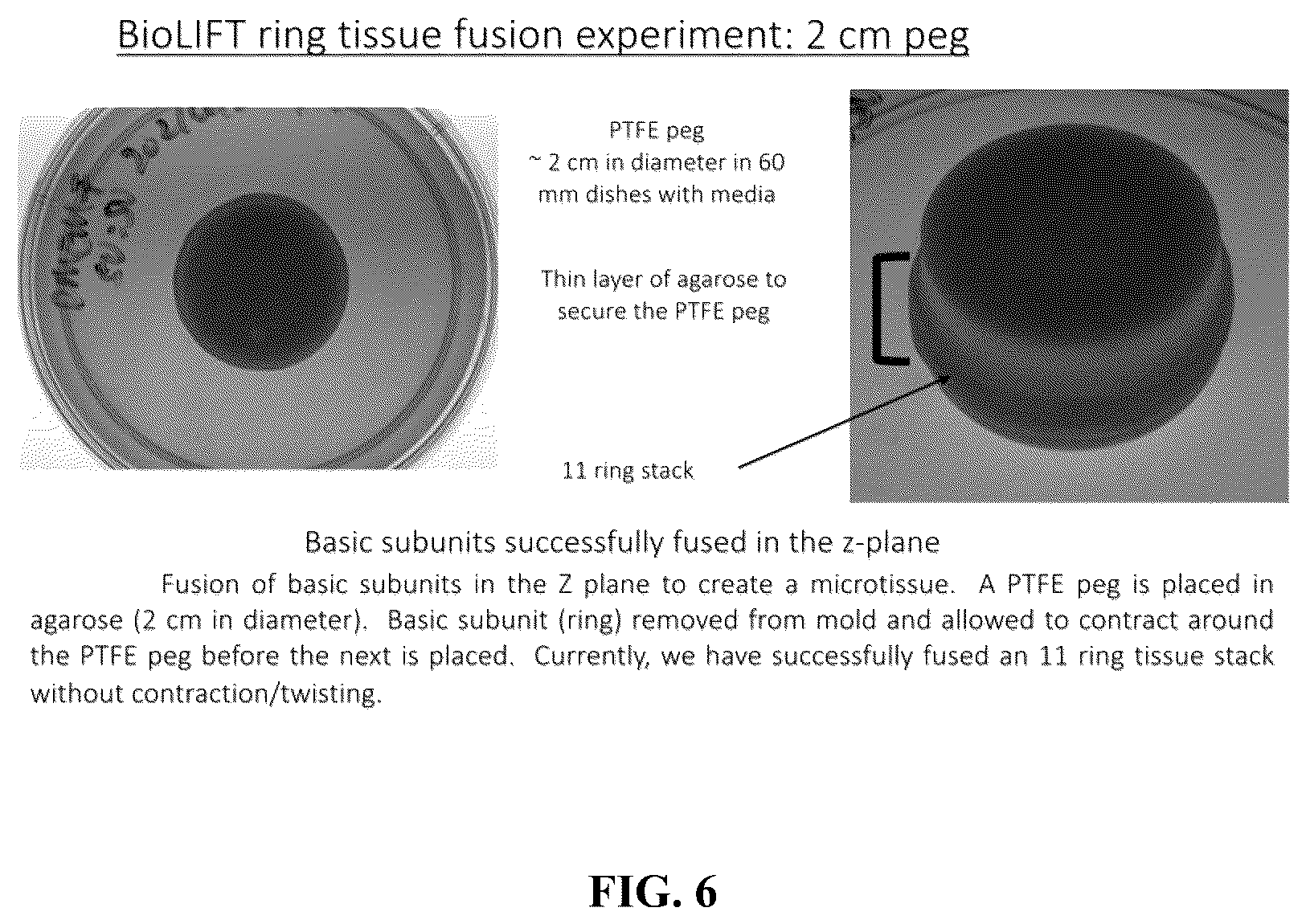 Patent US12564660 Figure 6 – Biofabrication of vaginal support using vaginally derived cells