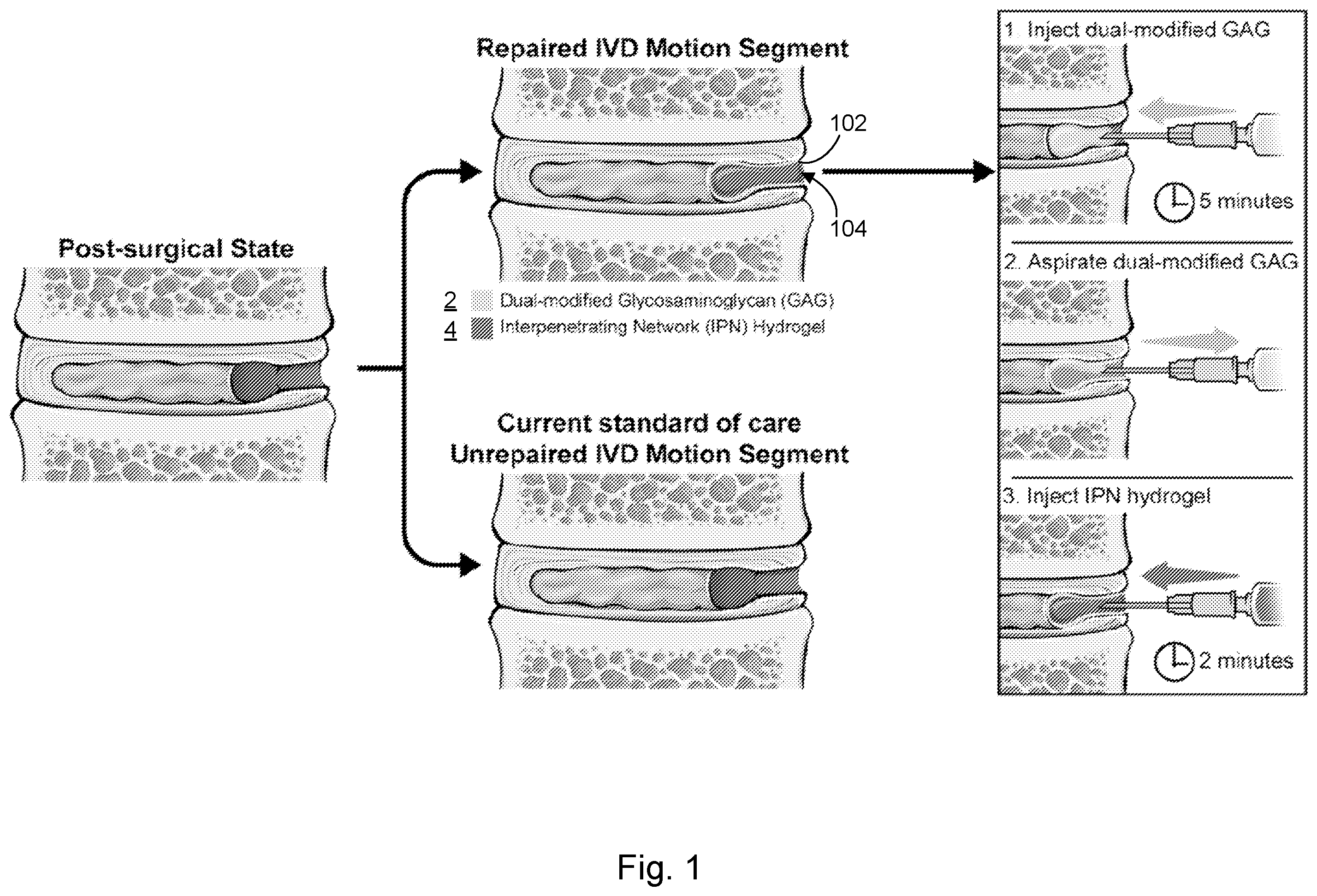 Patent US12564661 Figure 1 – Approach to repair tissue defects by bonding injectable gels to native soft tissues