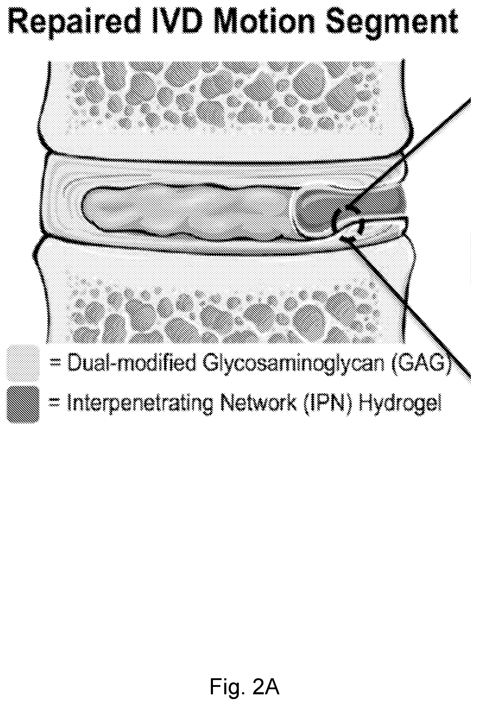 Patent US12564661 Figure 2 – Approach to repair tissue defects by bonding injectable gels to native soft tissues