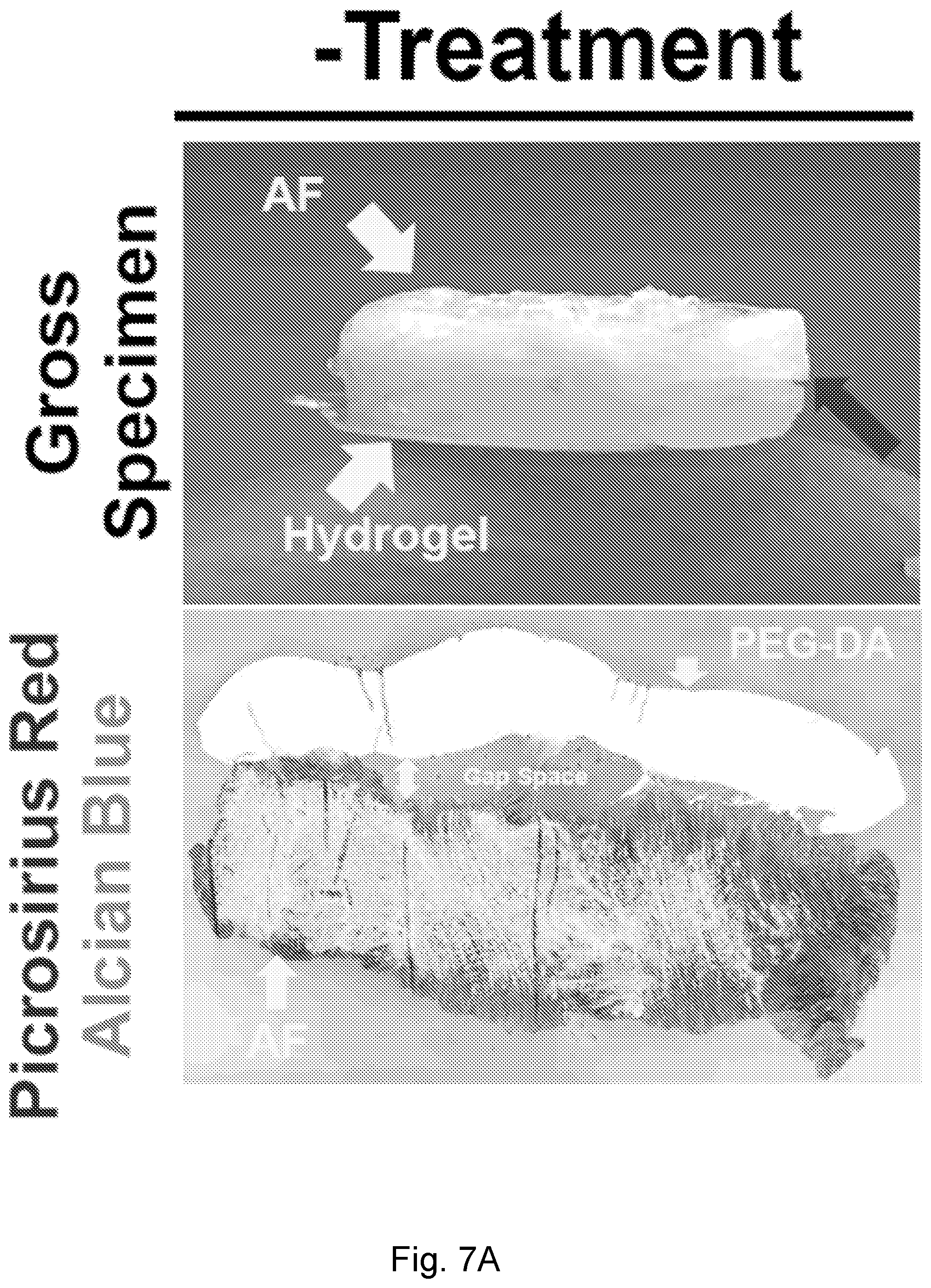 Patent US12564661 Figure 13 – Approach to repair tissue defects by bonding injectable gels to native soft tissues
