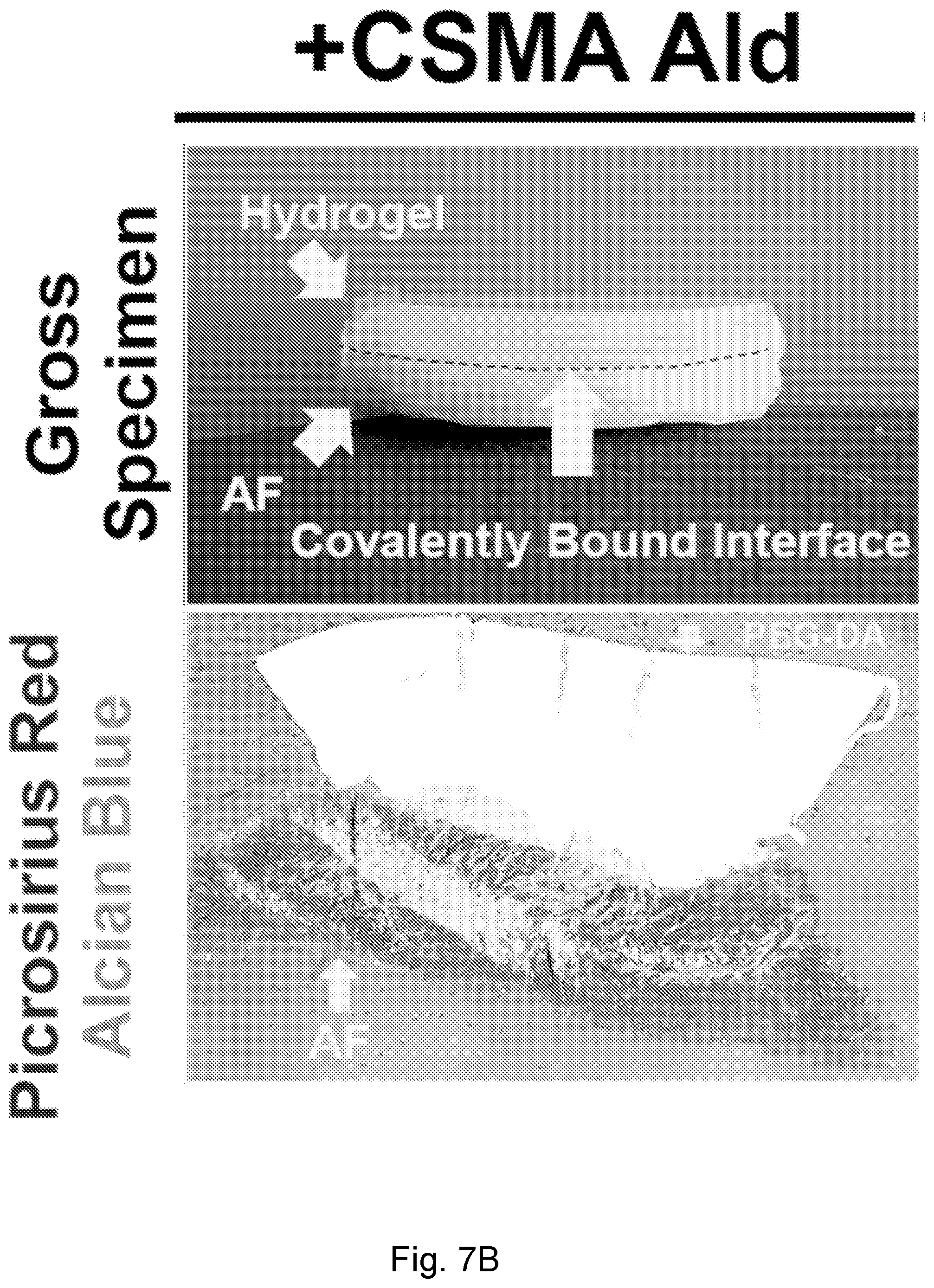 Patent US12564661 Figure 14 – Approach to repair tissue defects by bonding injectable gels to native soft tissues
