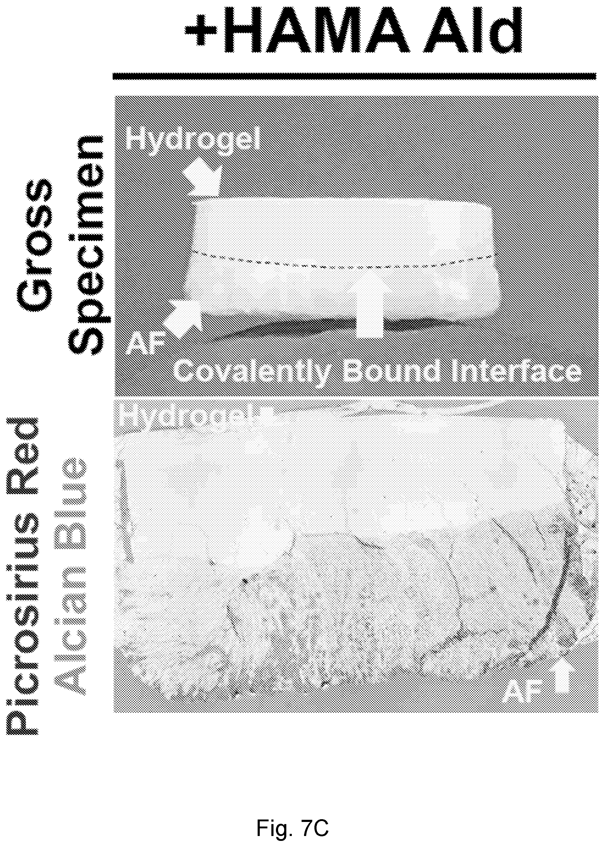 Patent US12564661 Figure 15 – Approach to repair tissue defects by bonding injectable gels to native soft tissues