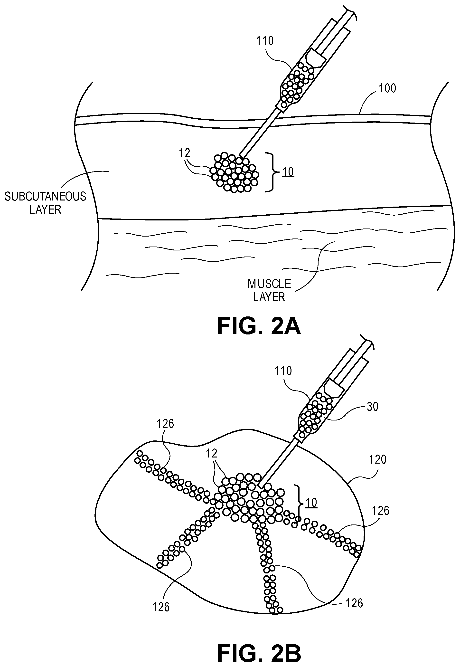 Patent US12564663 Figure 3 – Microporous annealed particle gel system