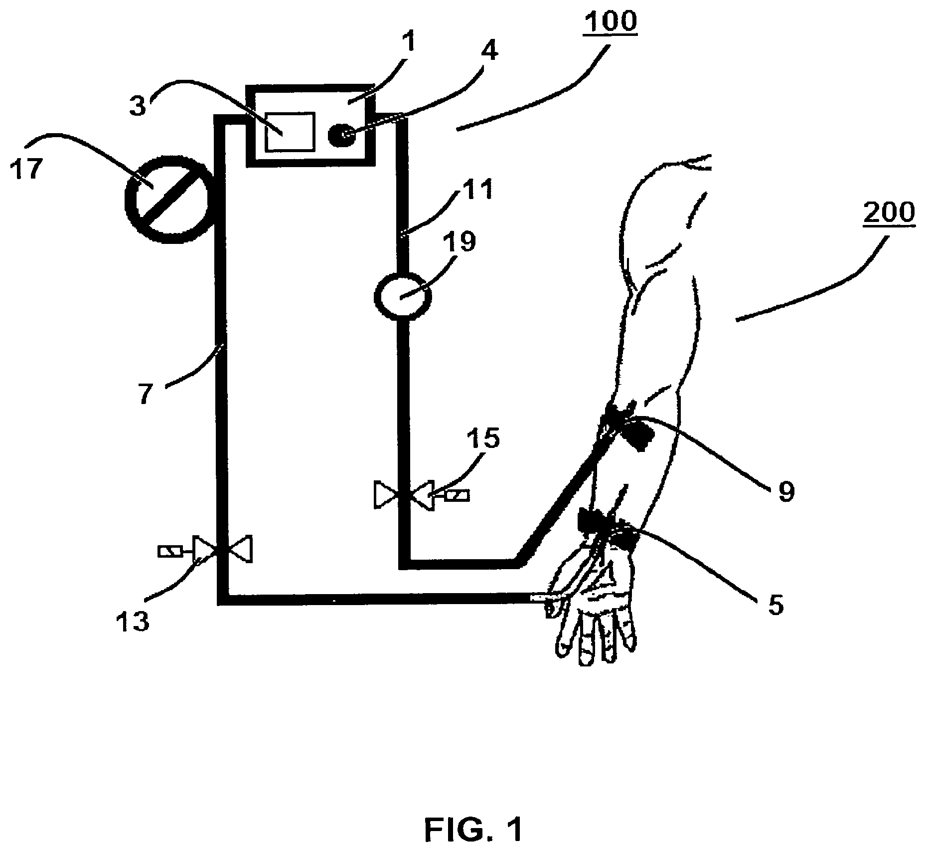 Patent US12564666 Figure 1 – Method for temporarily interrupting an extracorporeal blood treatment, control device and blood treatment apparatus