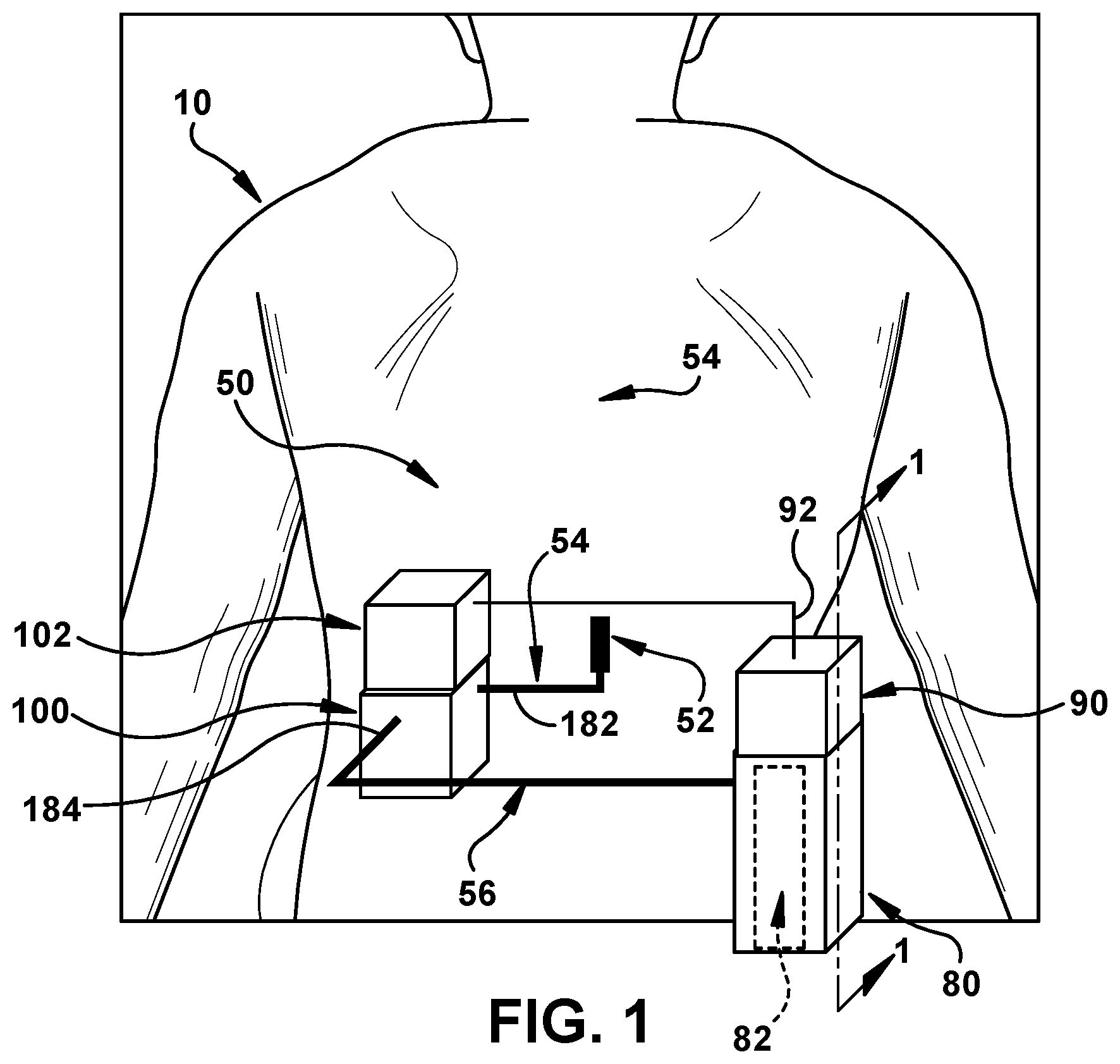 Patent US12564669 Figure 1 – Ambulatory fluid drainage and collection device