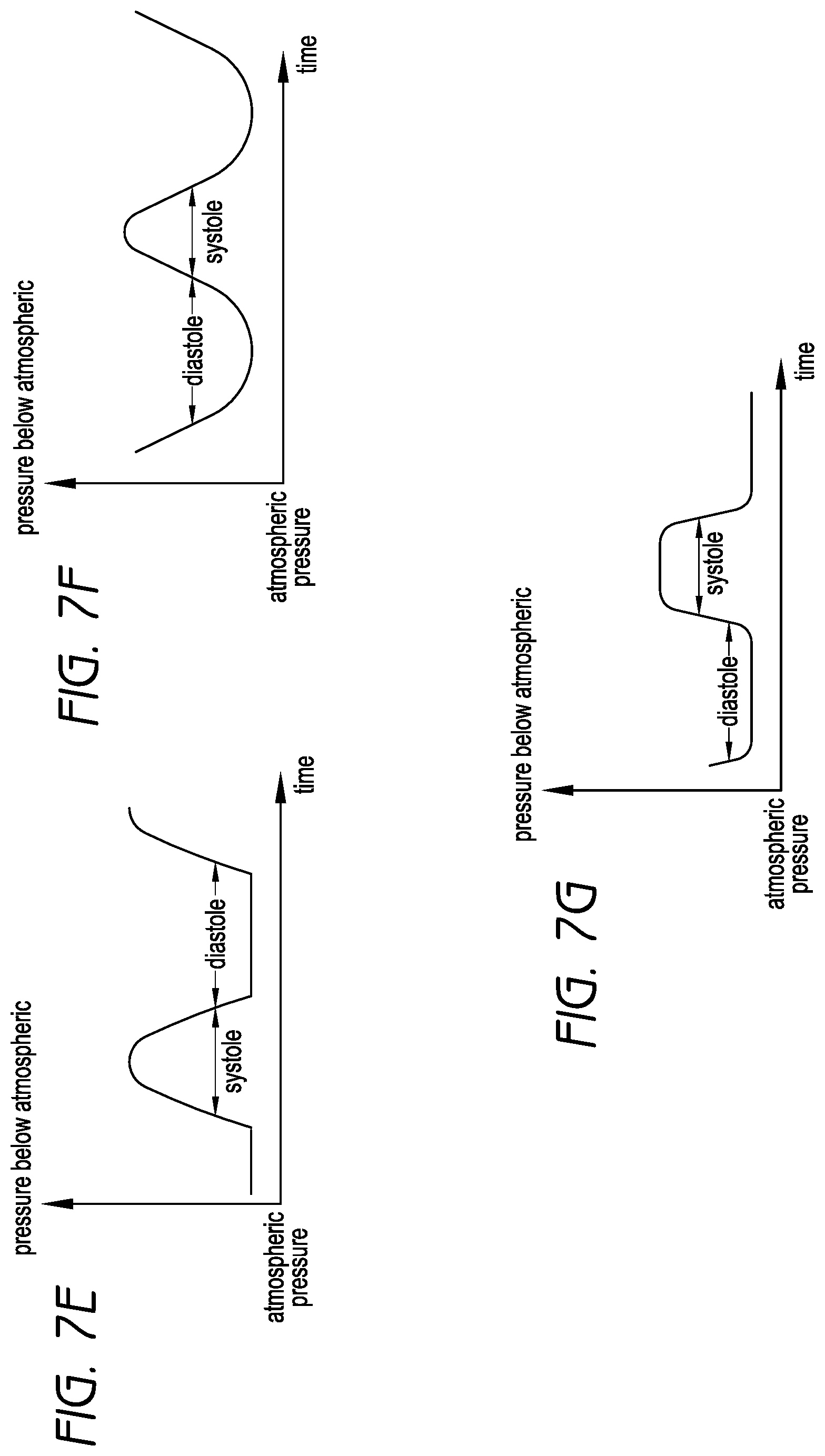 Patent US12564670 Figure 9 – Sustained variable negative pressure wound treatment and method of controlling same