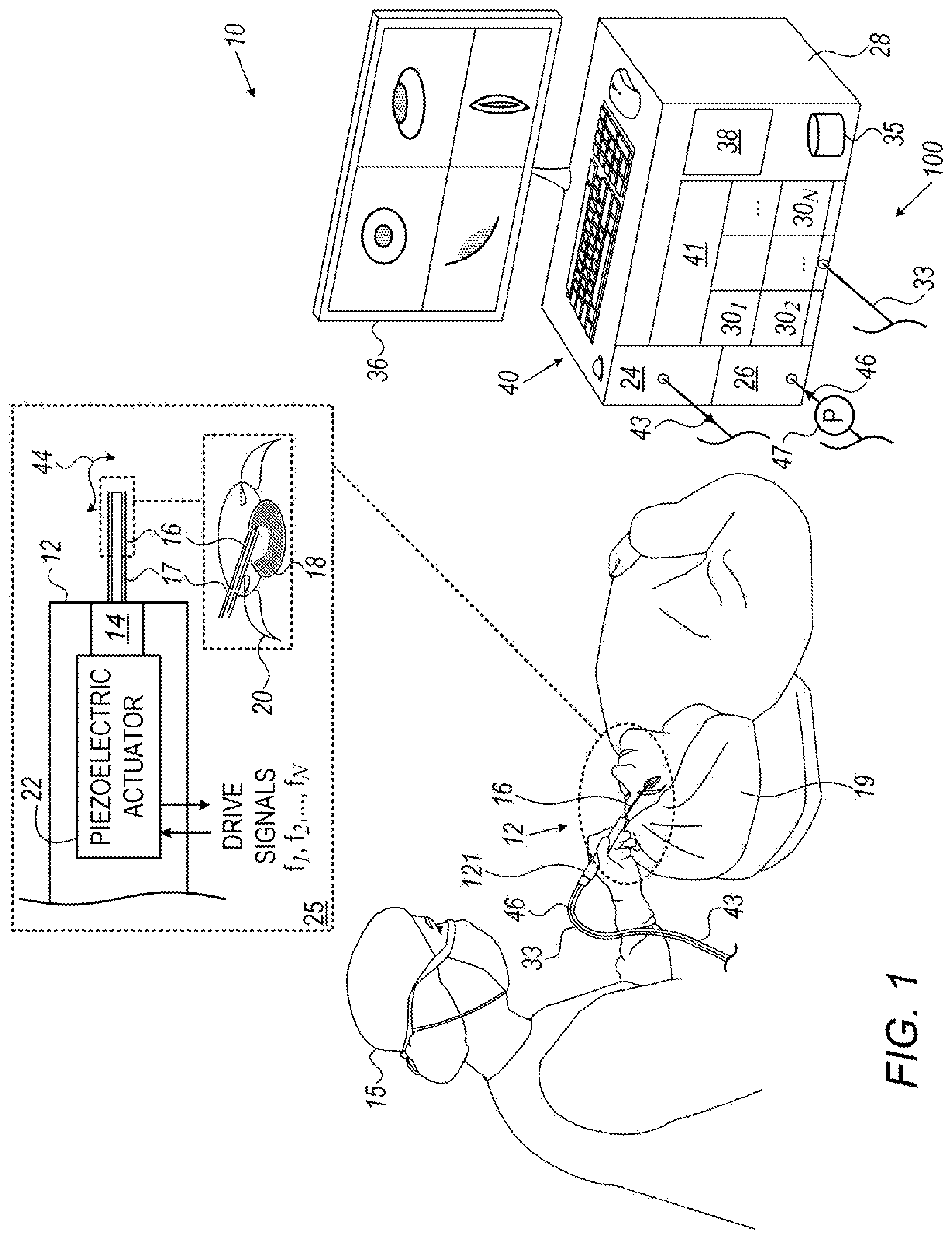 Patent US12564671 Figure 1 – Phacoemulsification irrigation apparatus with load cell and optical sensor