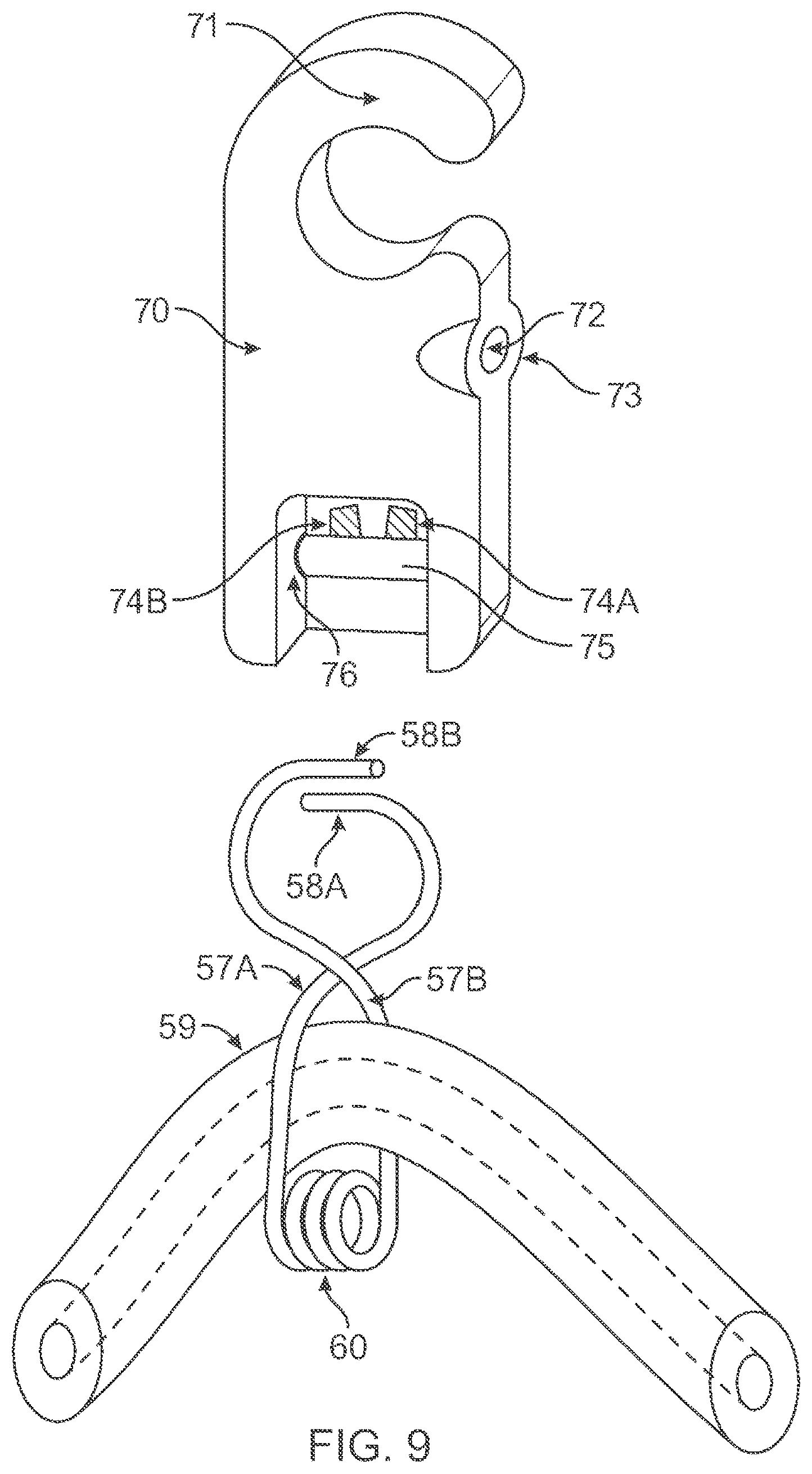 Patent US12564673 Figure 9 – Slack release system for medical tubing