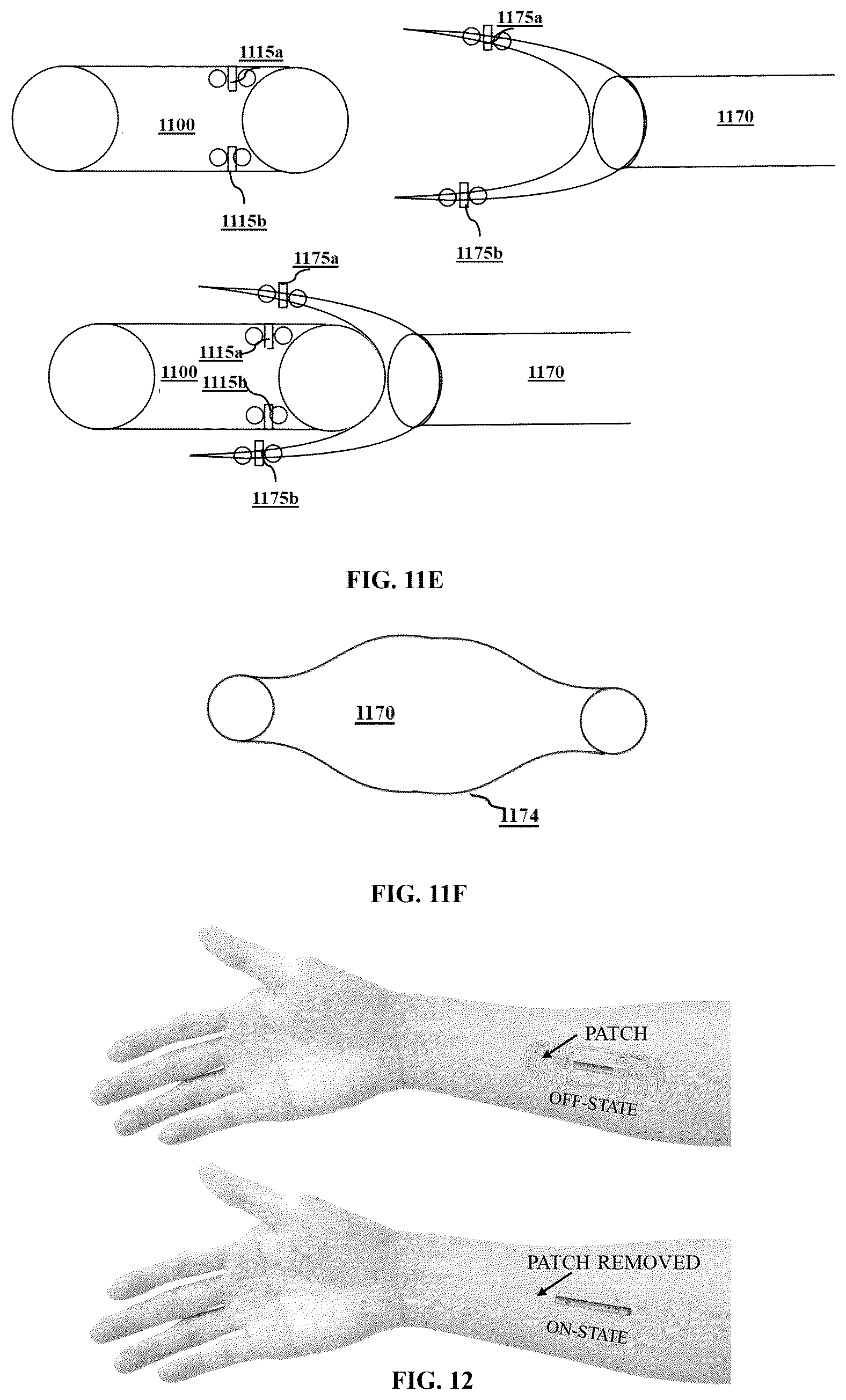 Patent US12564675 Figure 11 – Autopilot drug-delivery system