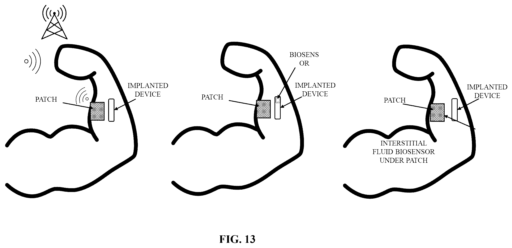 Patent US12564675 Figure 12 – Autopilot drug-delivery system