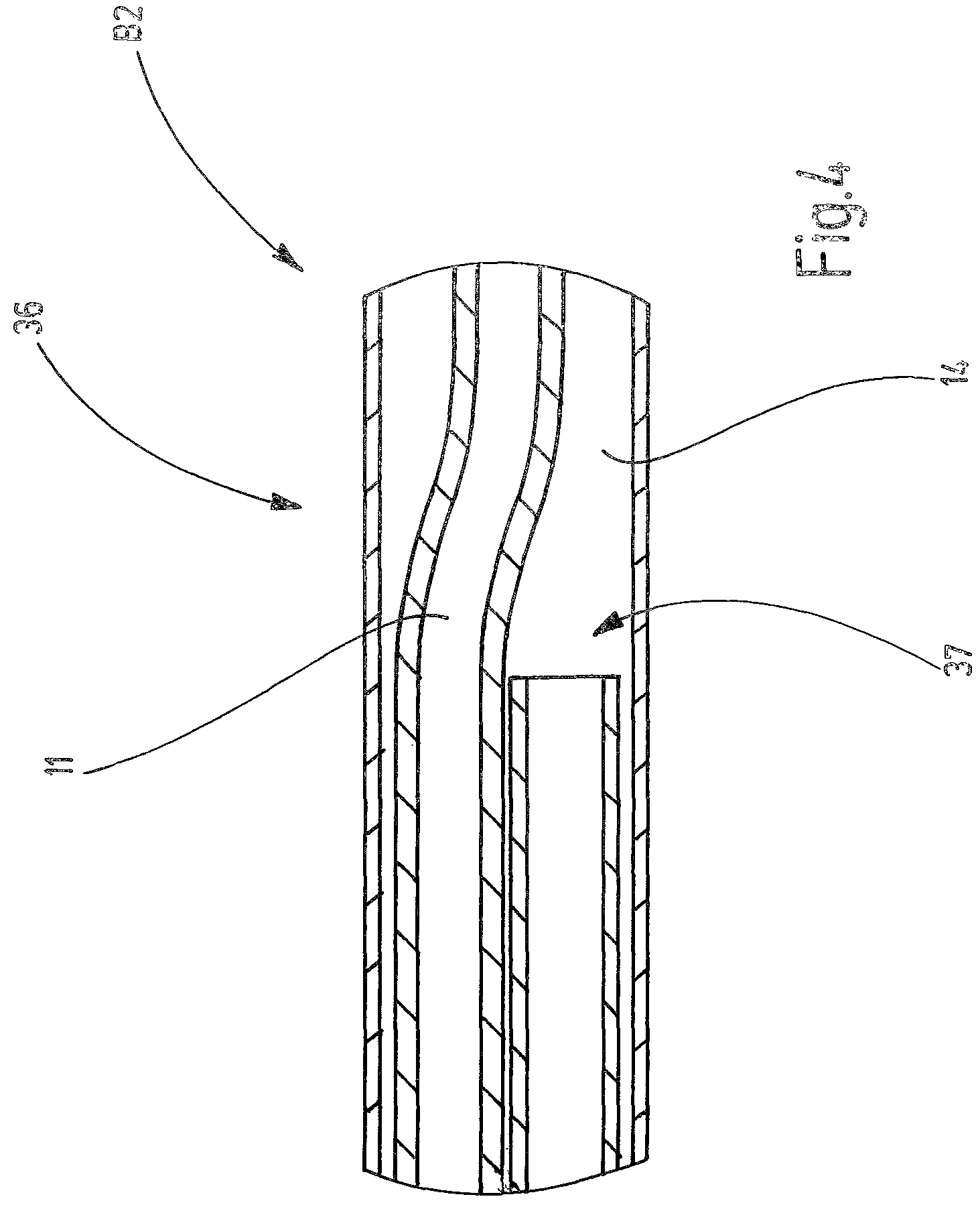 Patent US12564684 Figure 5 – Instrument, instrument head, application system and method