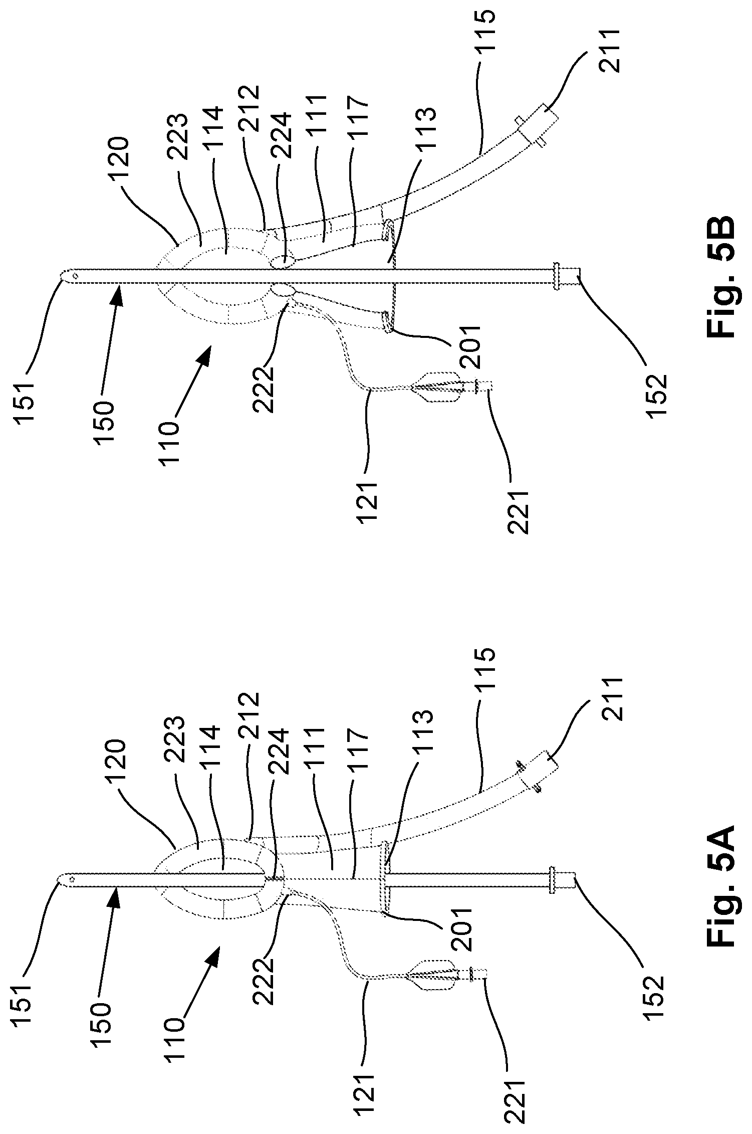Patent US12564693 Figure 11 – Laryngeal mask airway intubation guide and method