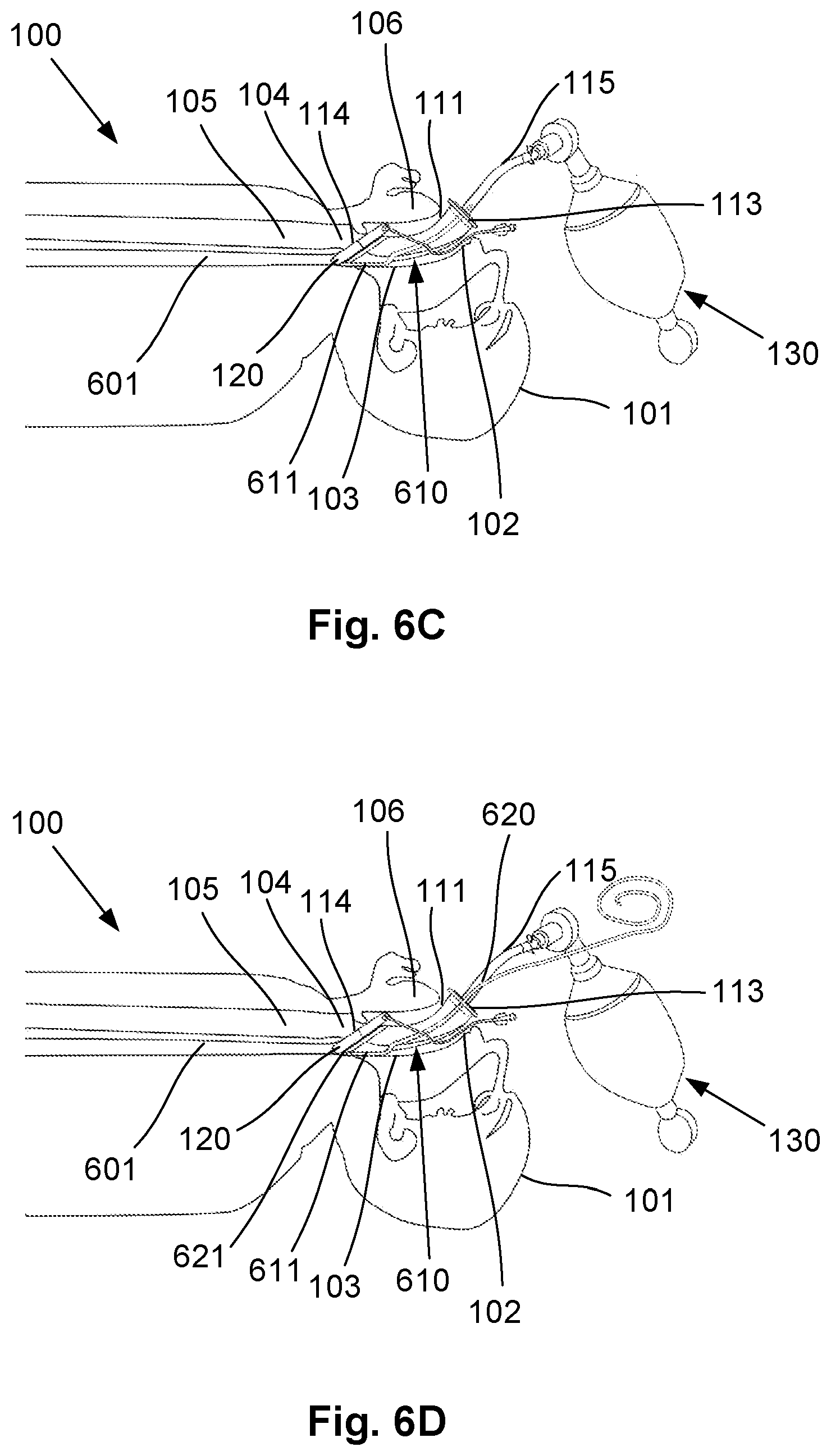 Patent US12564693 Figure 13 – Laryngeal mask airway intubation guide and method