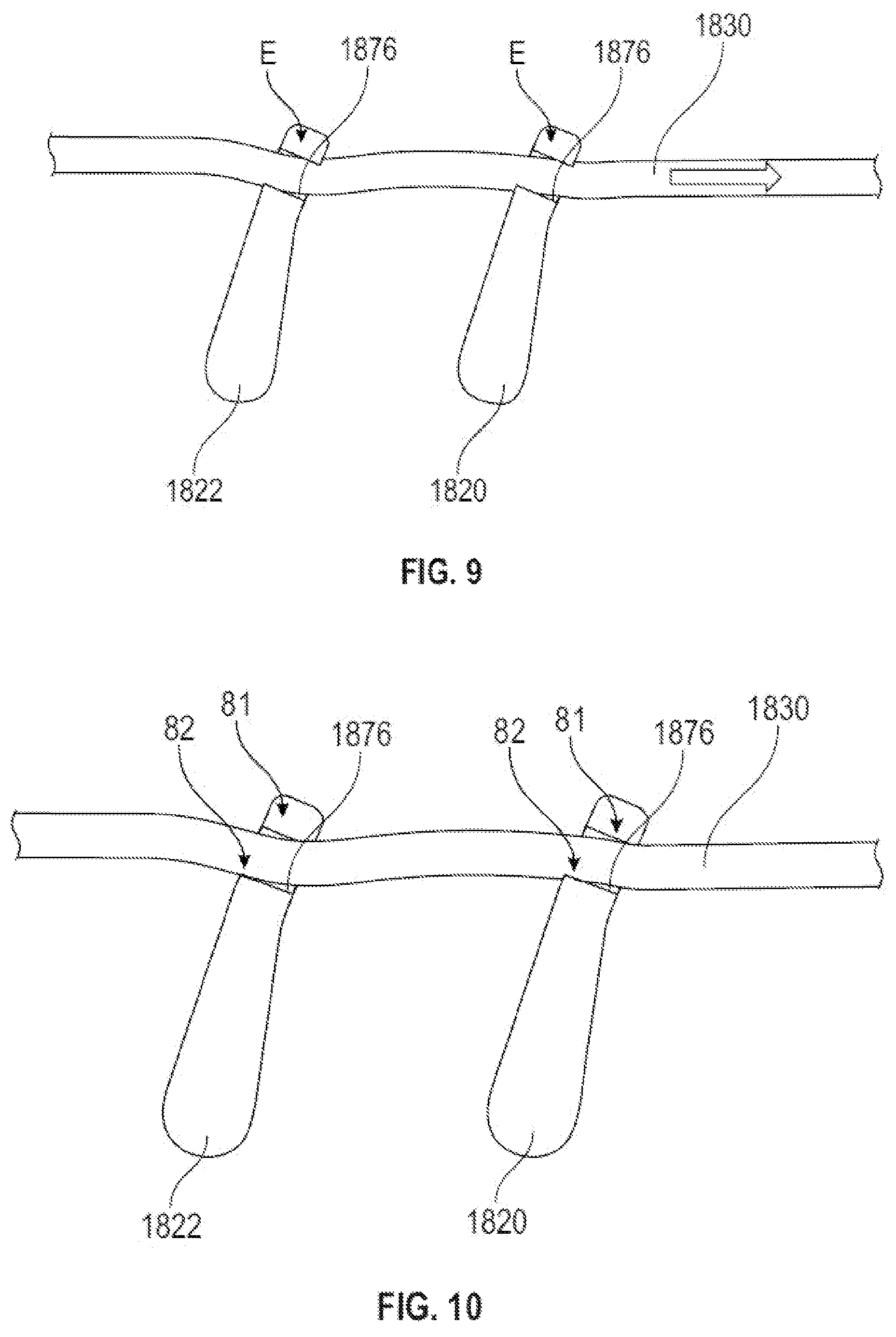 Patent US12564695 Figure 12 – Directional adjustment mechanism for headgear of a respiratory therapy mask or interface