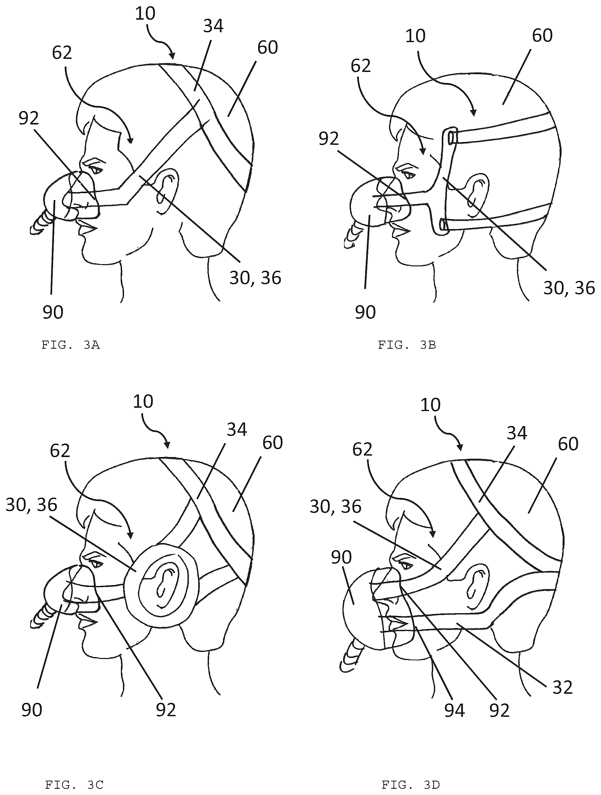 Patent US12564696 Figure 3 – Harness with eyeglass region