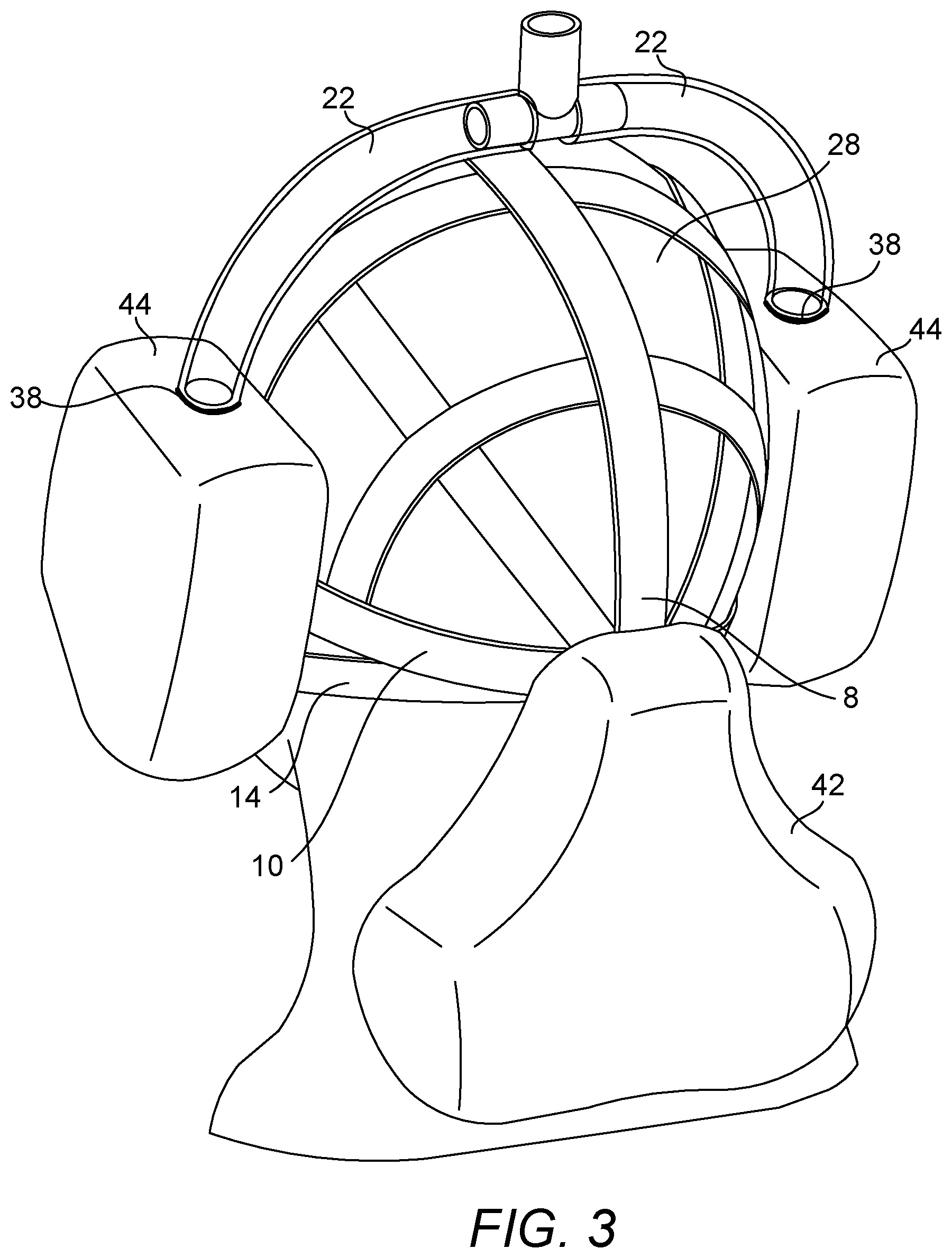 Patent US12564697 Figure 3 – Breathing mask and methods thereof