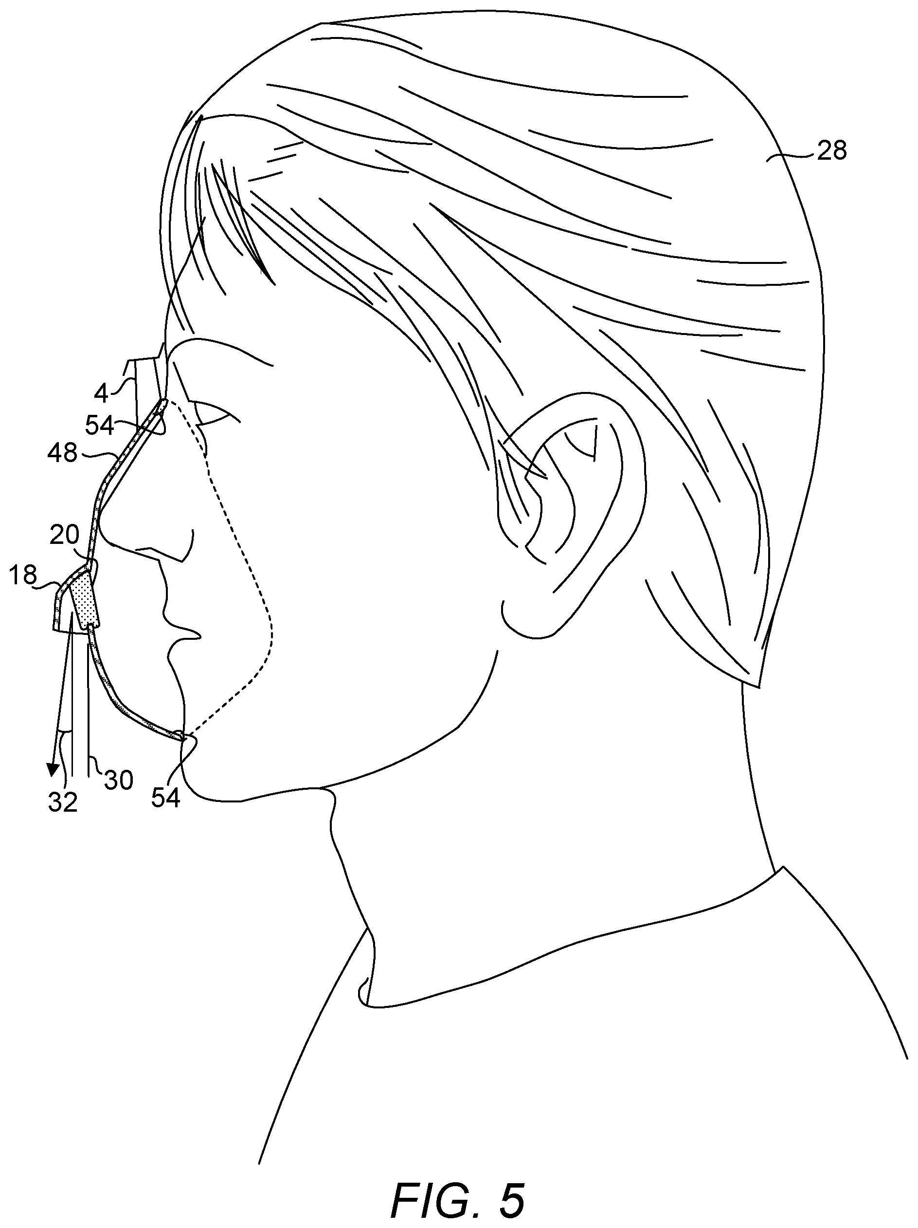Patent US12564697 Figure 5 – Breathing mask and methods thereof