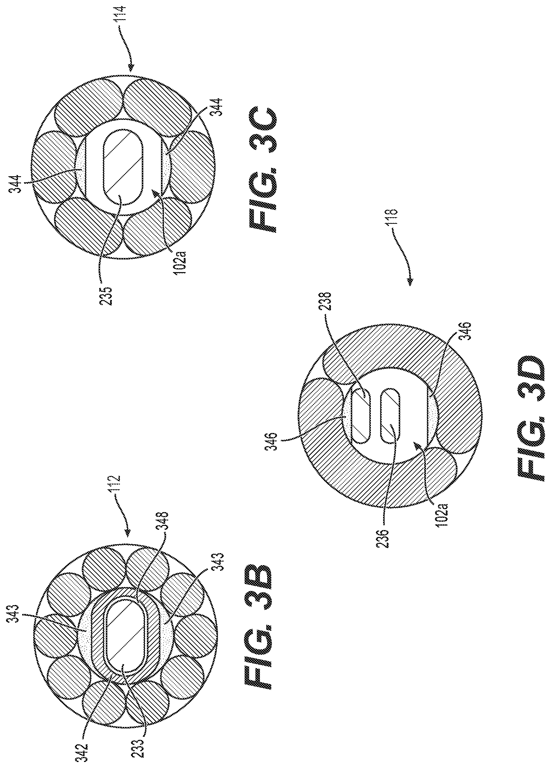 Patent US12564704 Figure 4 – Intraluminal device with looped core wire